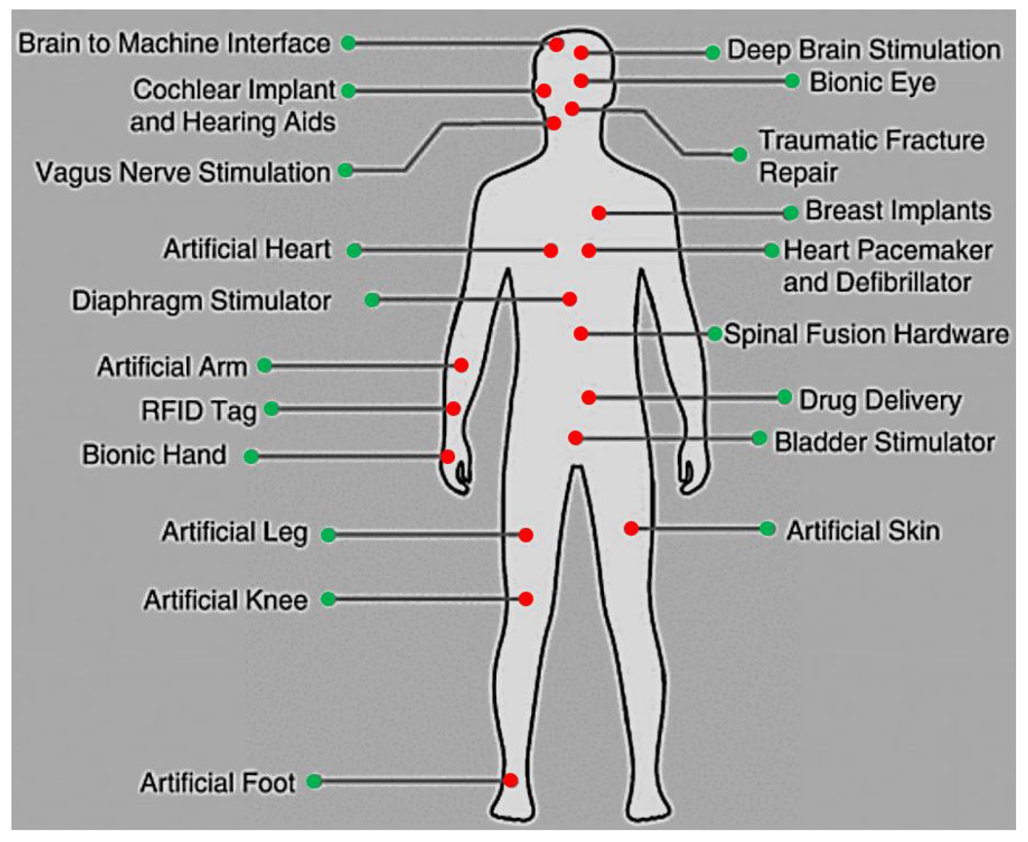 Sensors Free FullText Amplifiers in Biomedical Engineering A