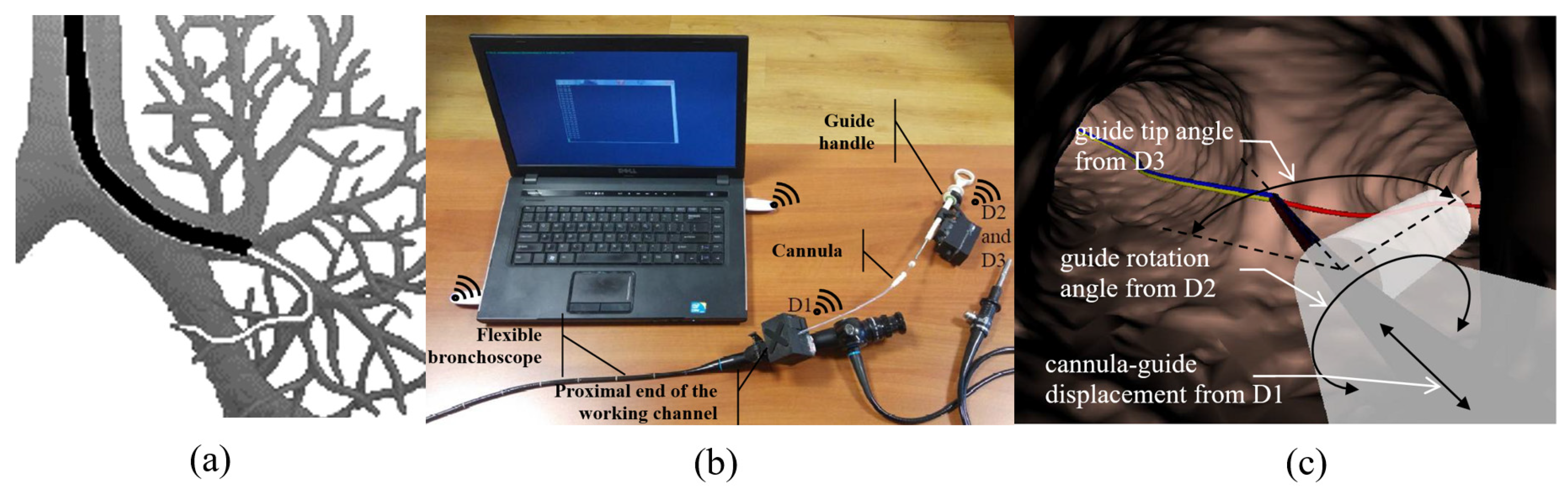 Sensors 23 02306 g001
