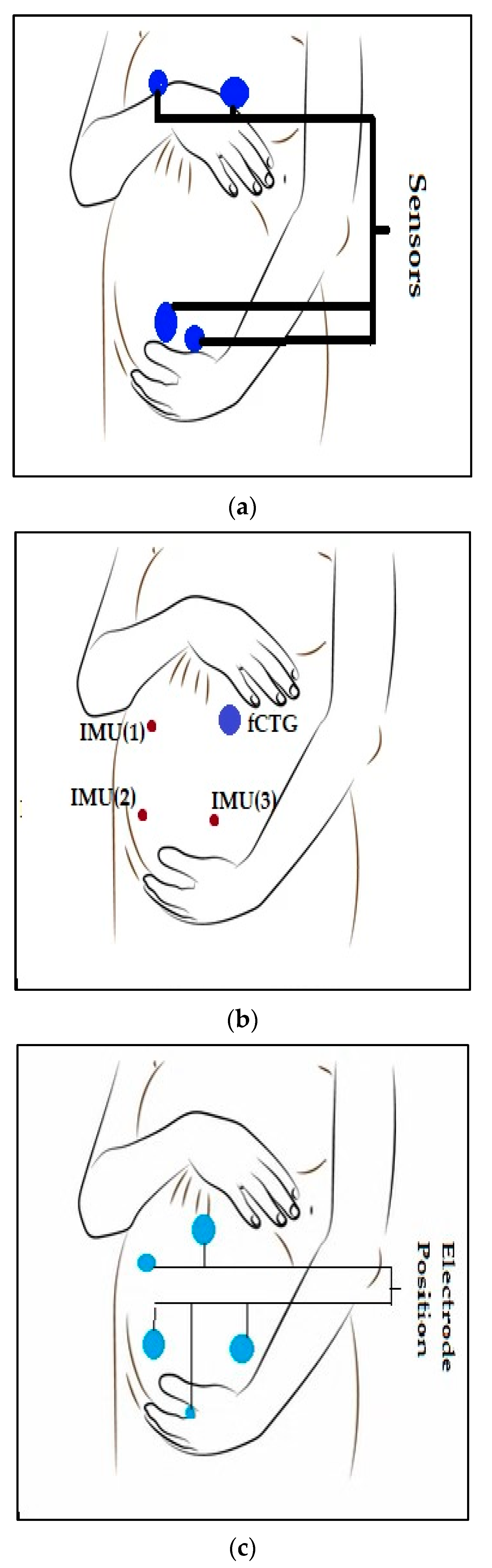 Sensors 23 02411 g003
