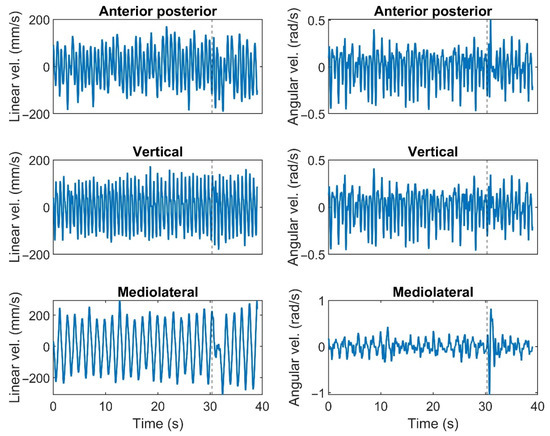 Trunk Velocity Changes in Response to Physical Perturbations Are ...