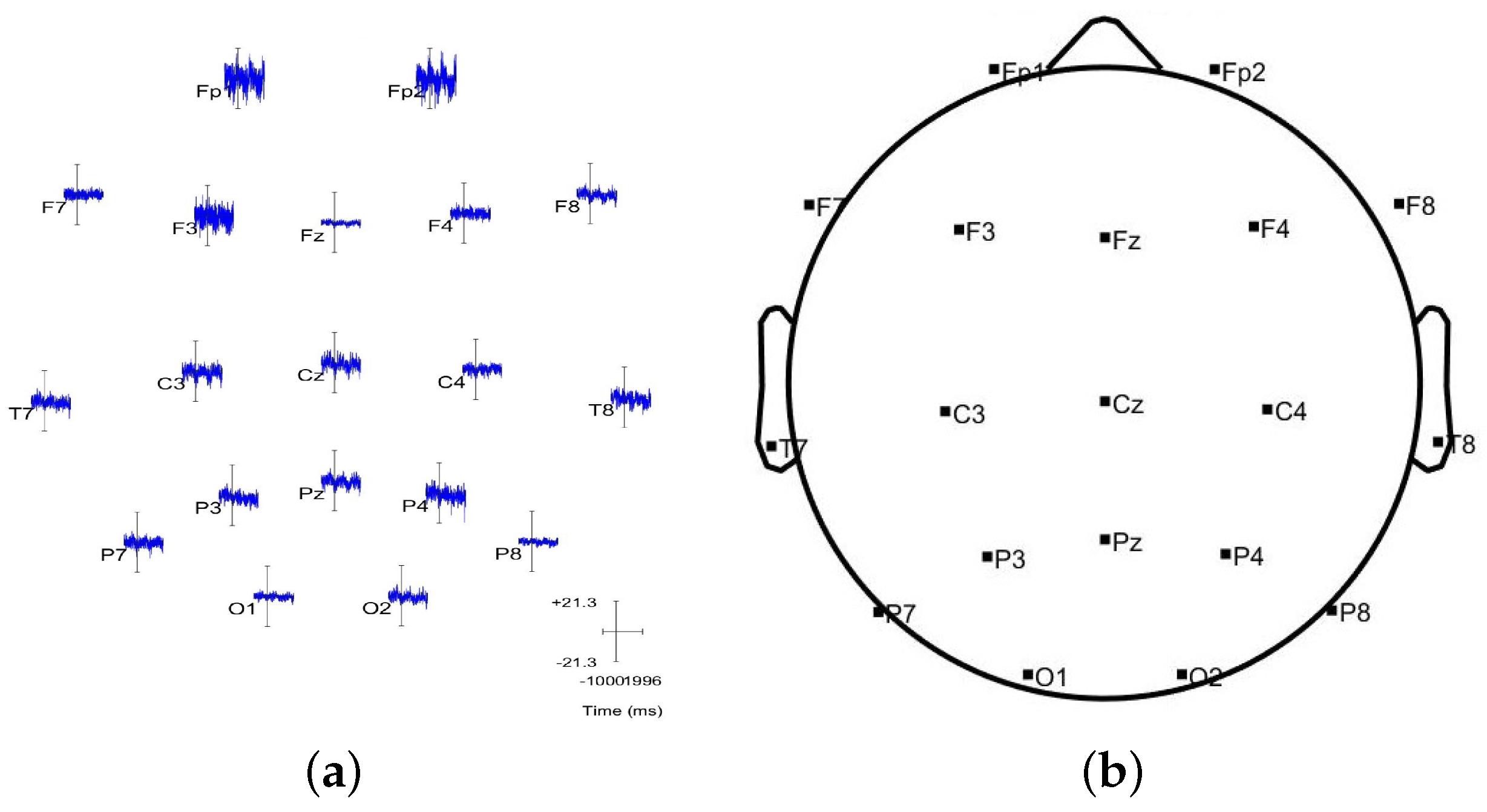 Sensors 23 02855 g022