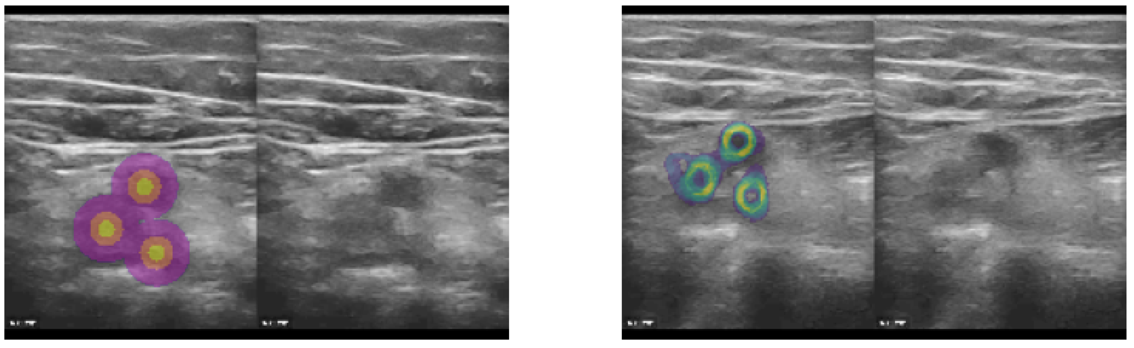 Sensors 23 02876 g003