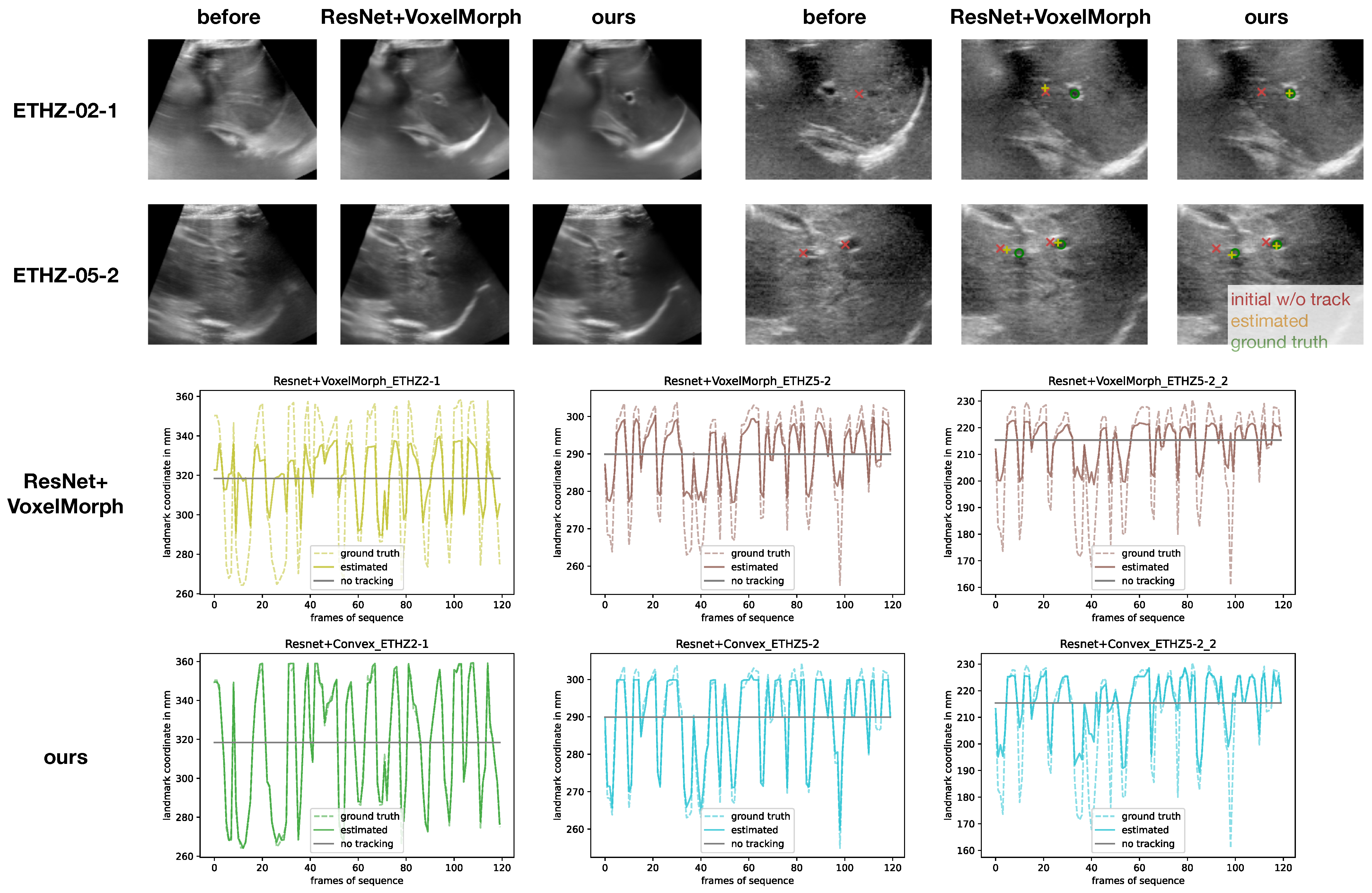 Sensors 23 02876 g005