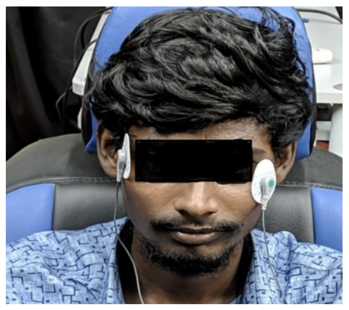 Sensors 23 02944 g004 Sensors 23 02944 g004