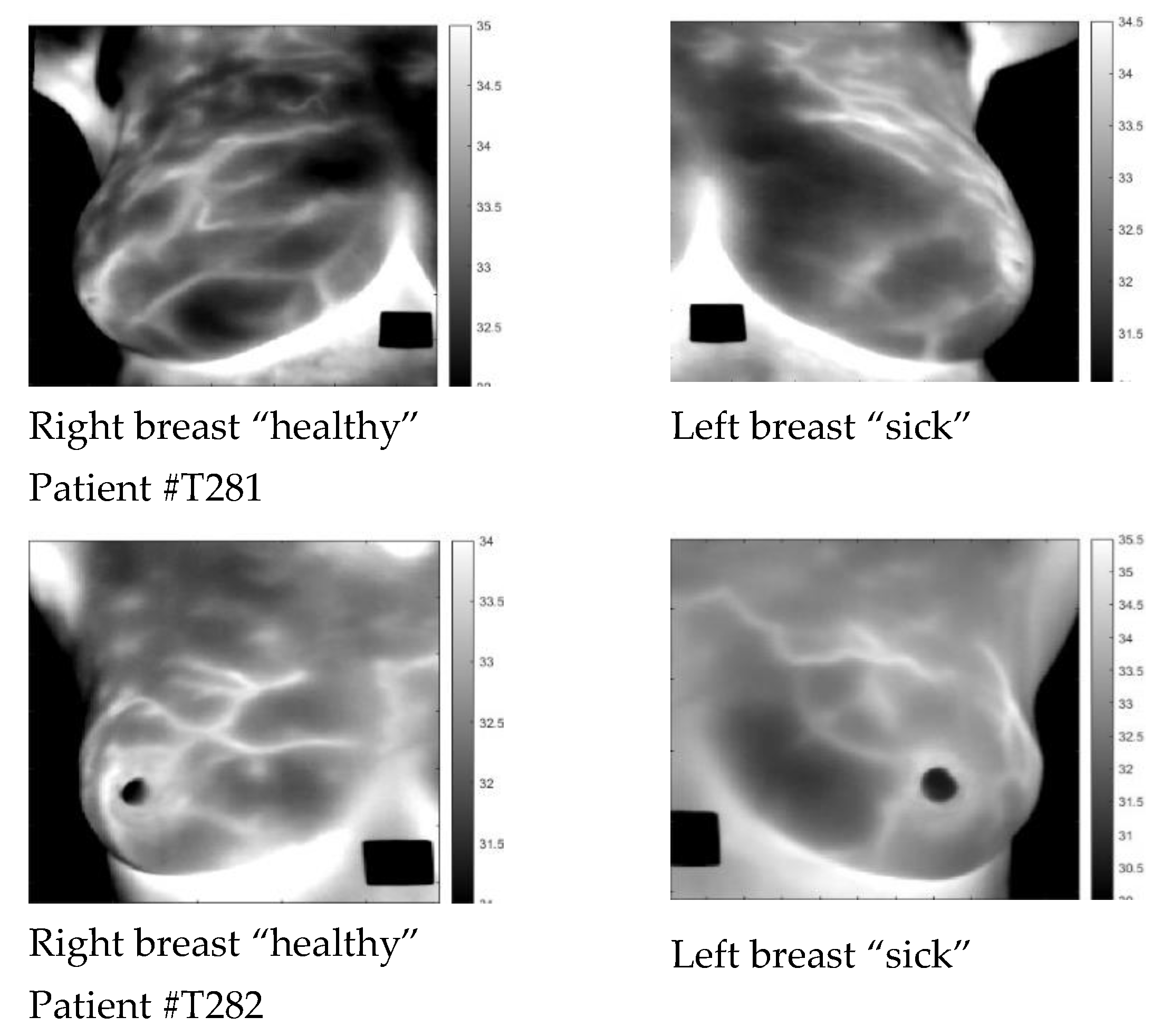 Sensors 23 03012 g001