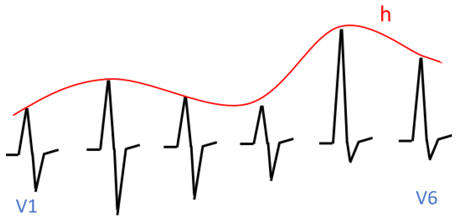 Sensors 23 03017 g010