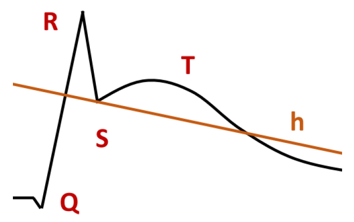 Sensors 23 03017 g011