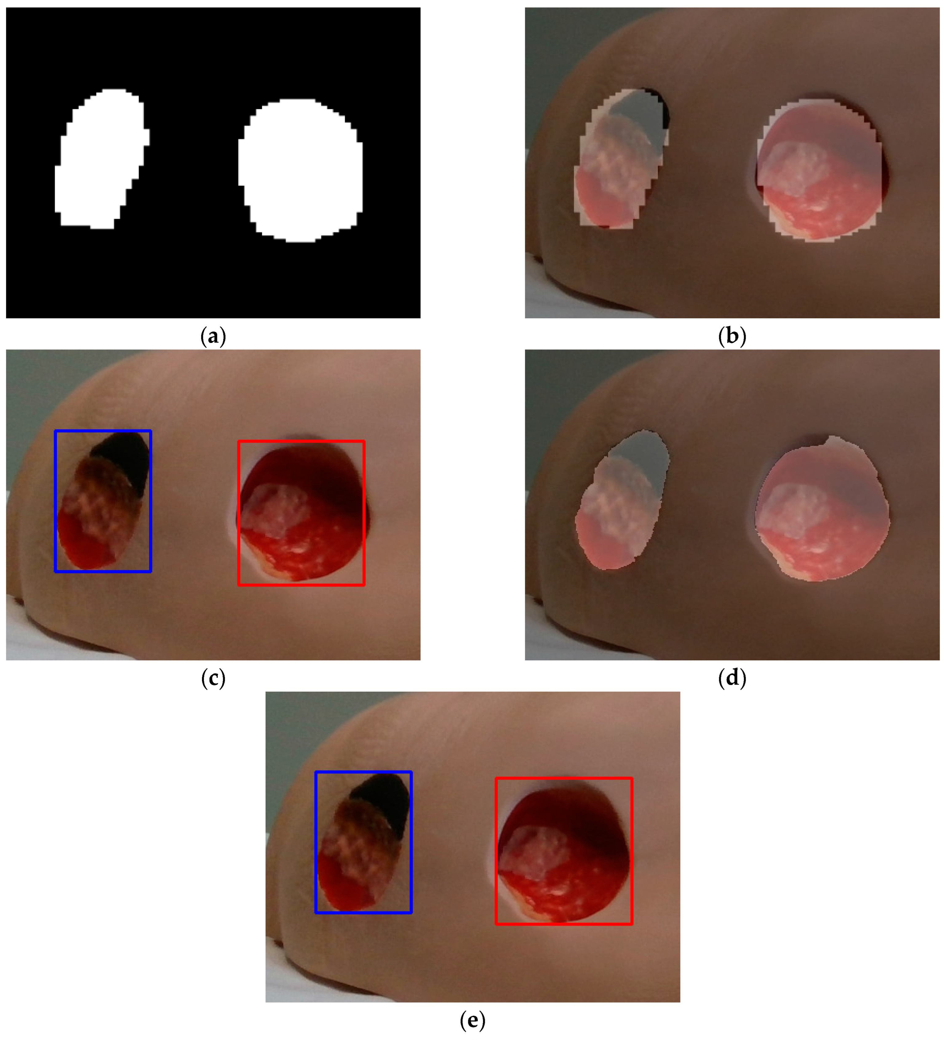 Sensors 23 03298 g006