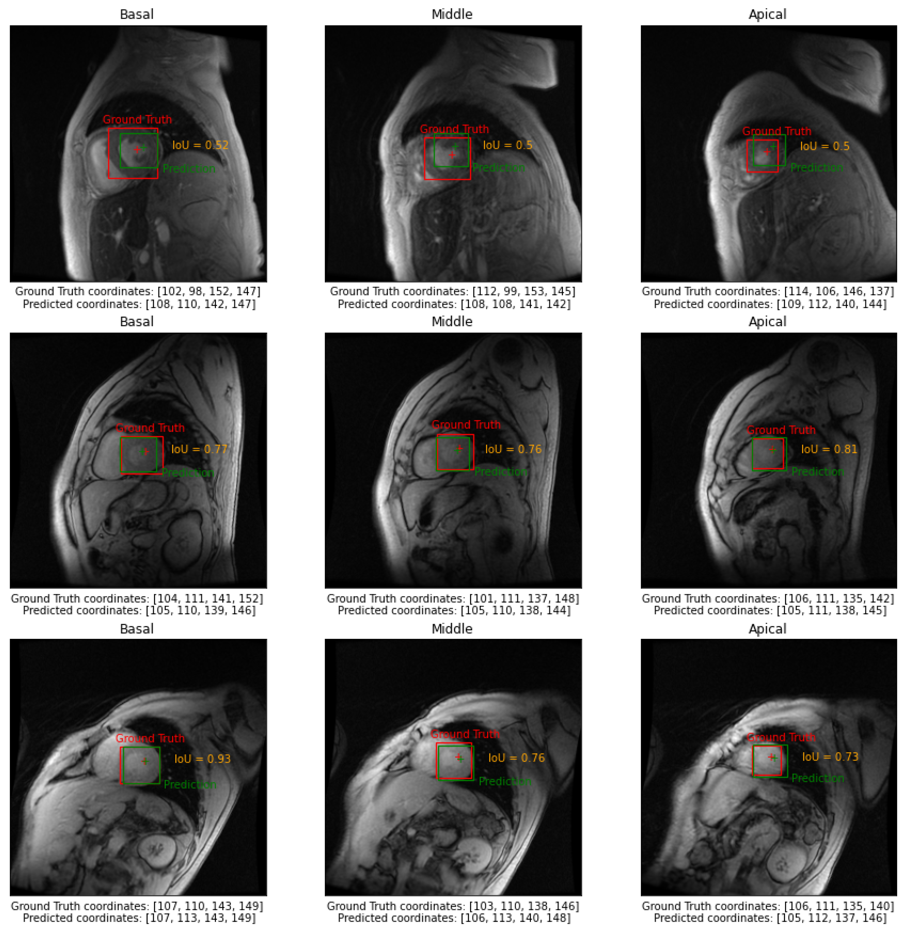Sensors 23 03321 g003