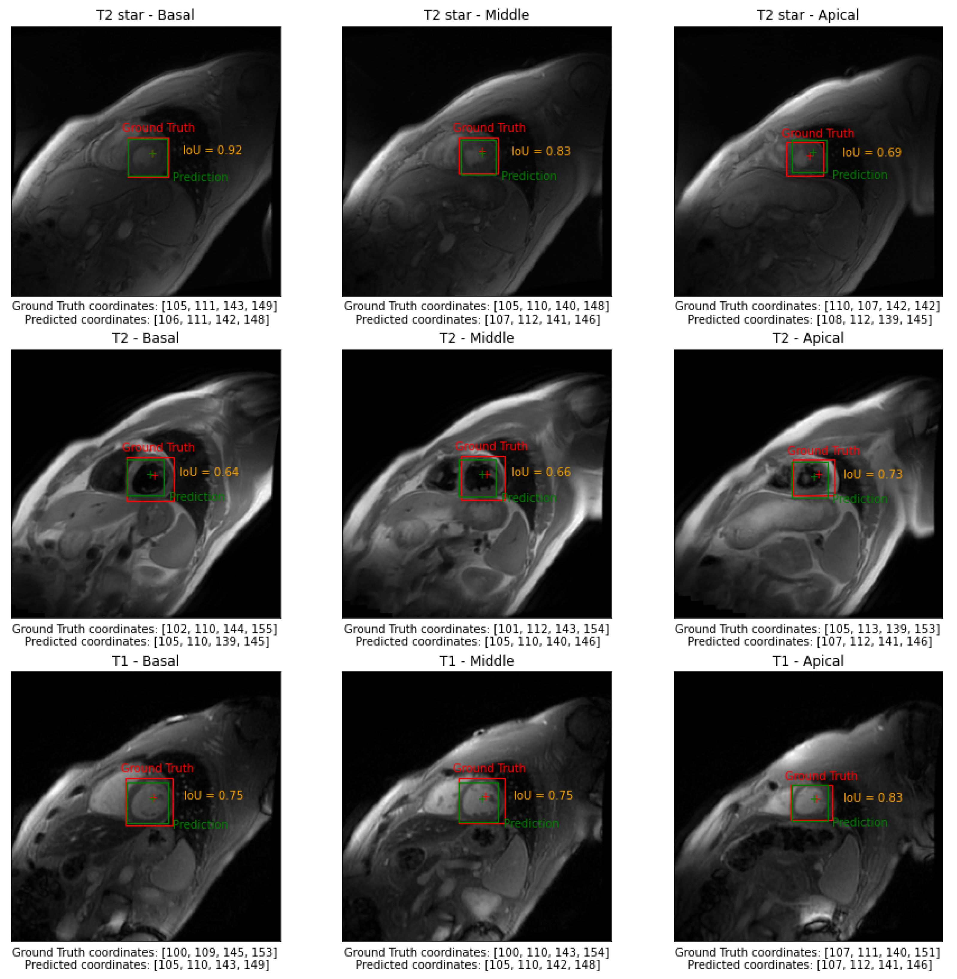 Sensors 23 03321 g004