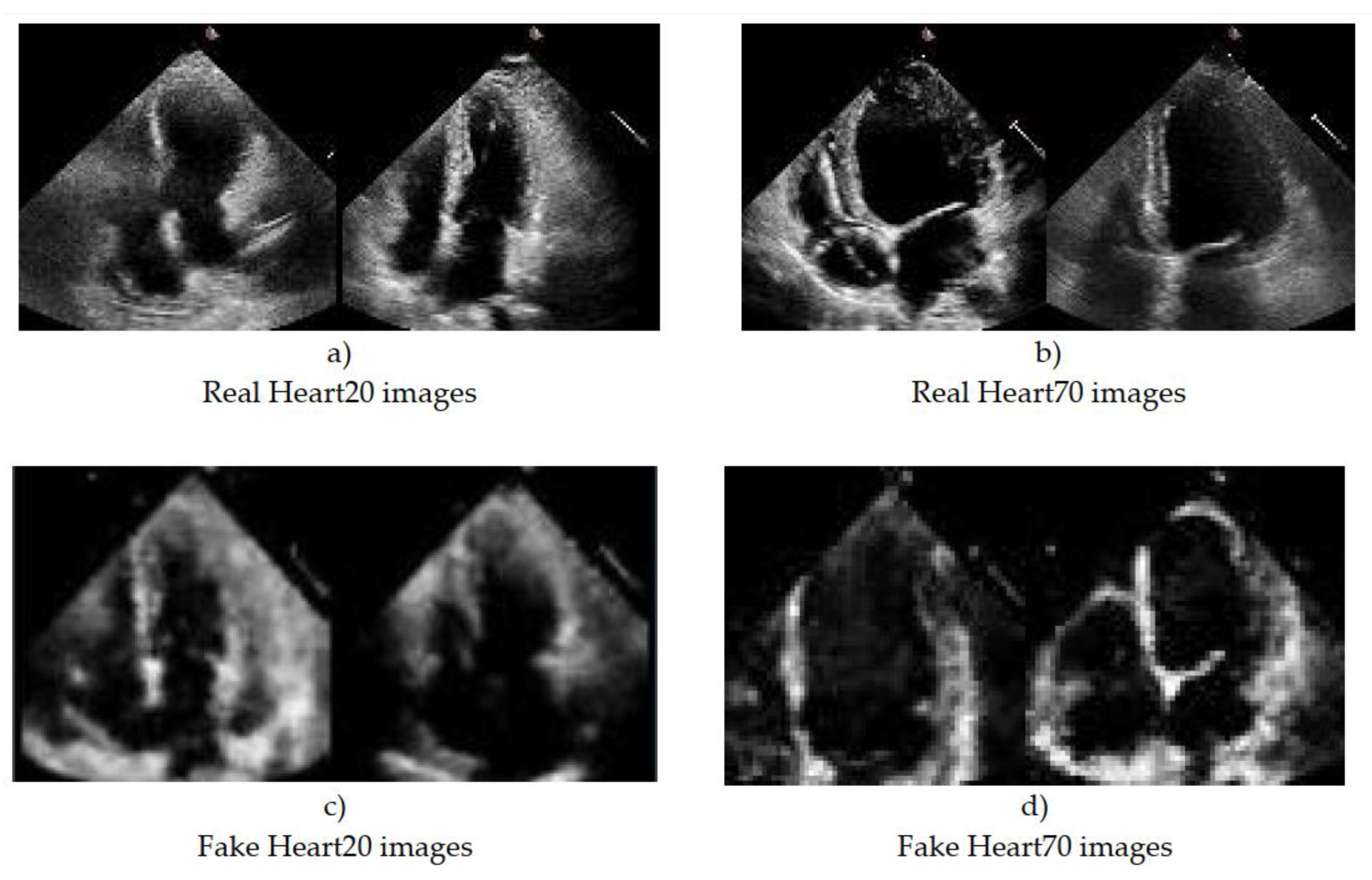 Sensors 23 03440 g005