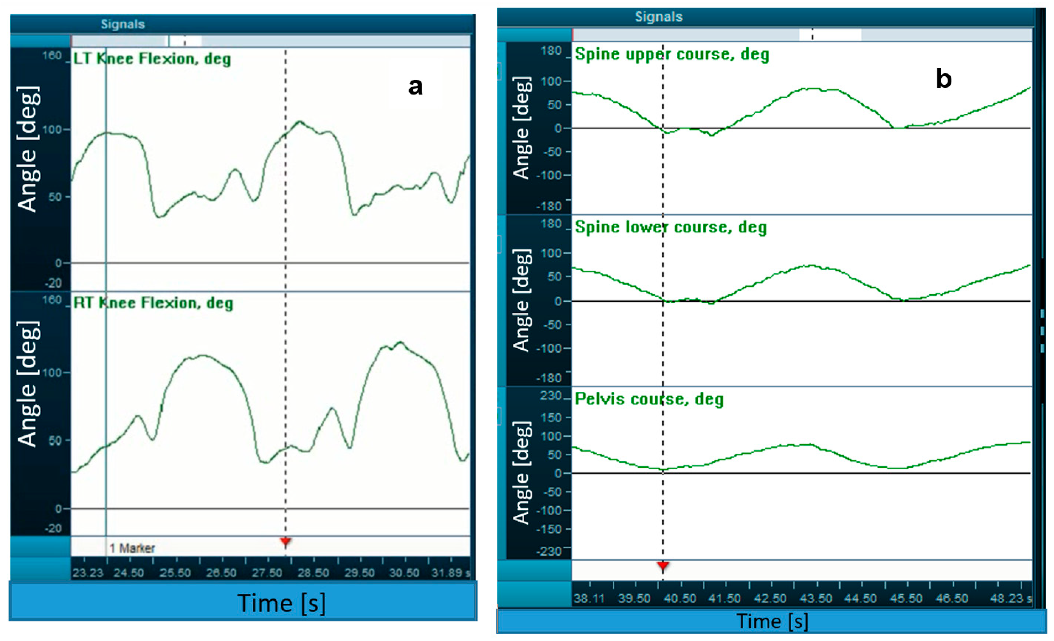 Sensors 23 03448 g003