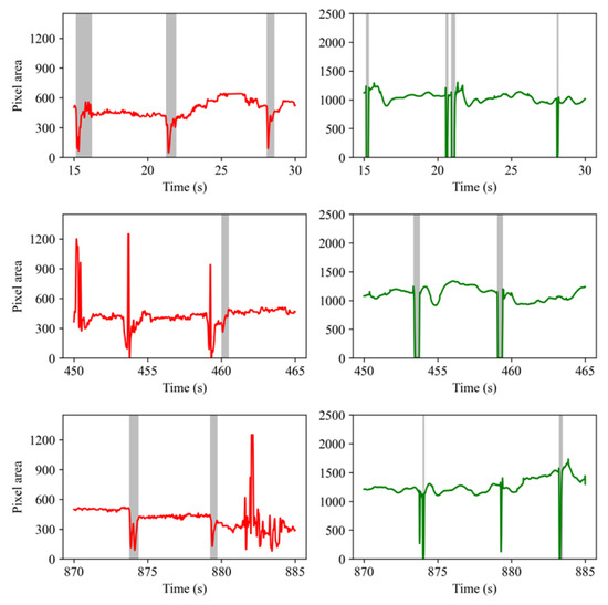 A CNN-Based Wearable System for Driver Drowsiness Detection
