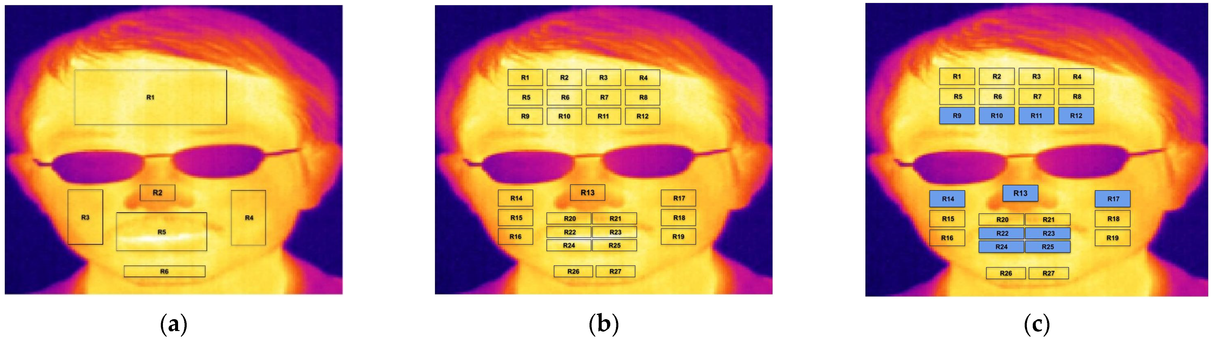 Sensors 23 03513 g003