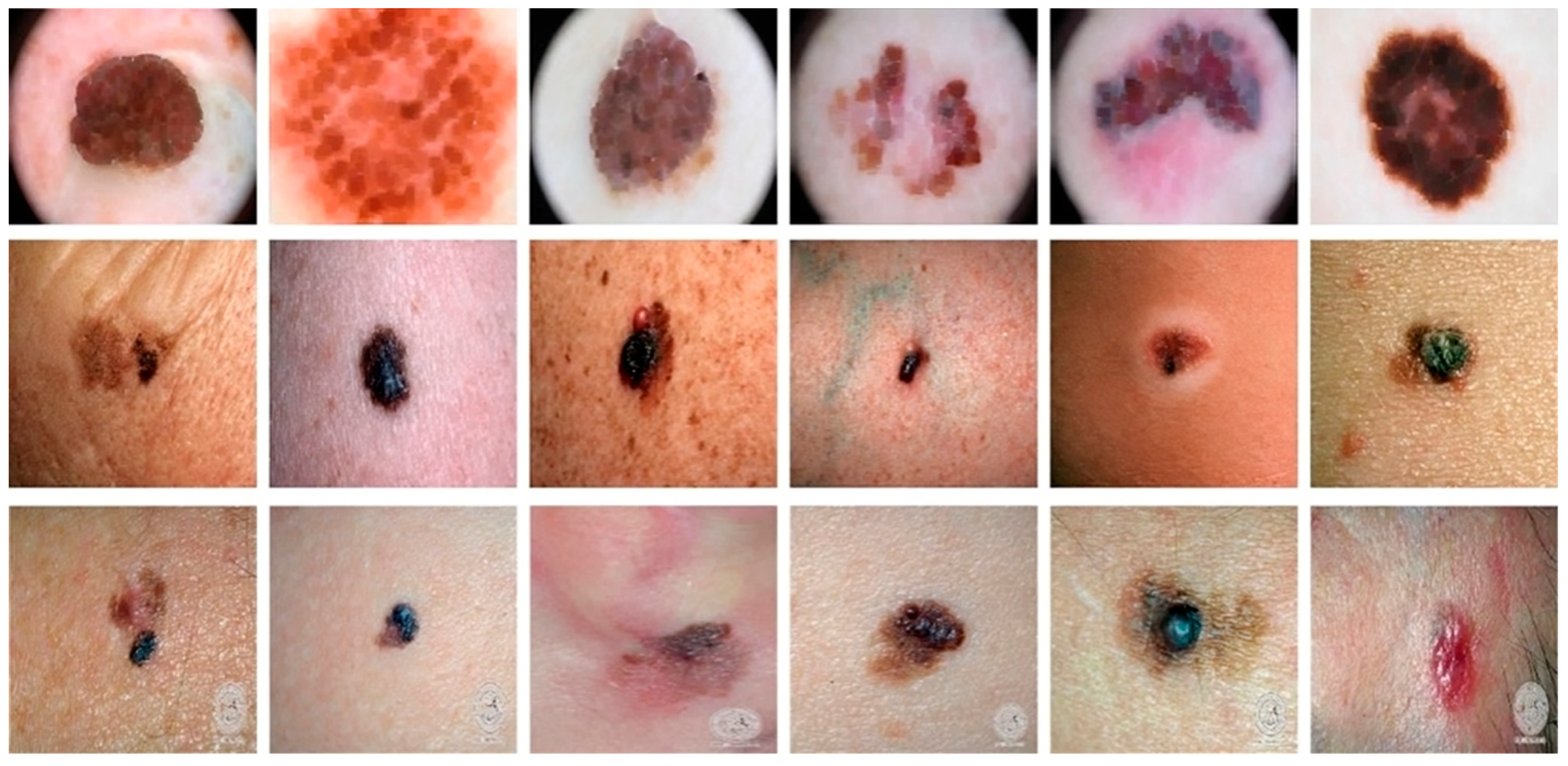 Sensors 23 03548 g004