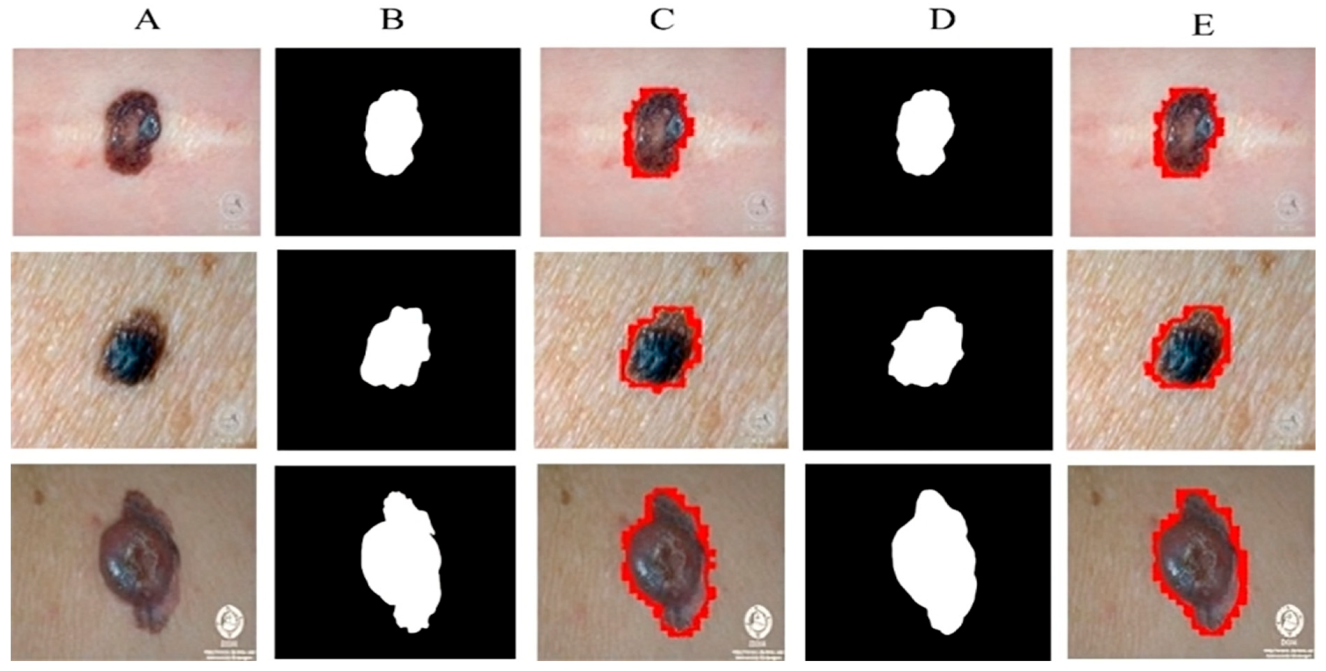Sensors 23 03548 g006