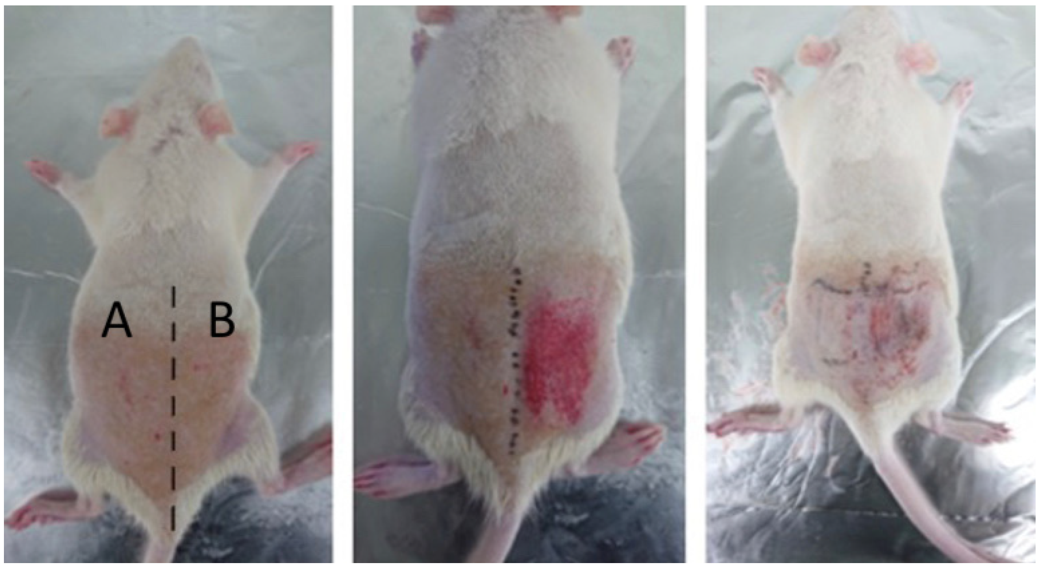 Sensors 23 03620 g005