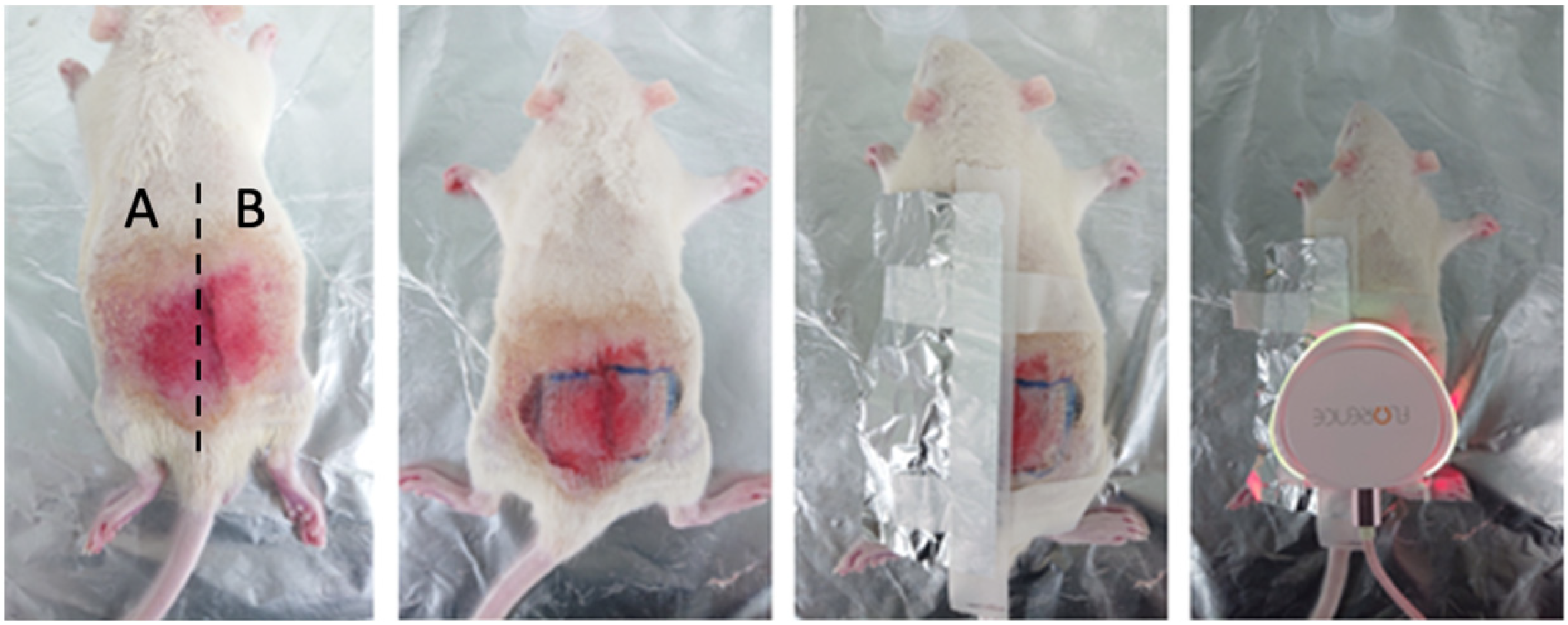 Sensors 23 03620 g006