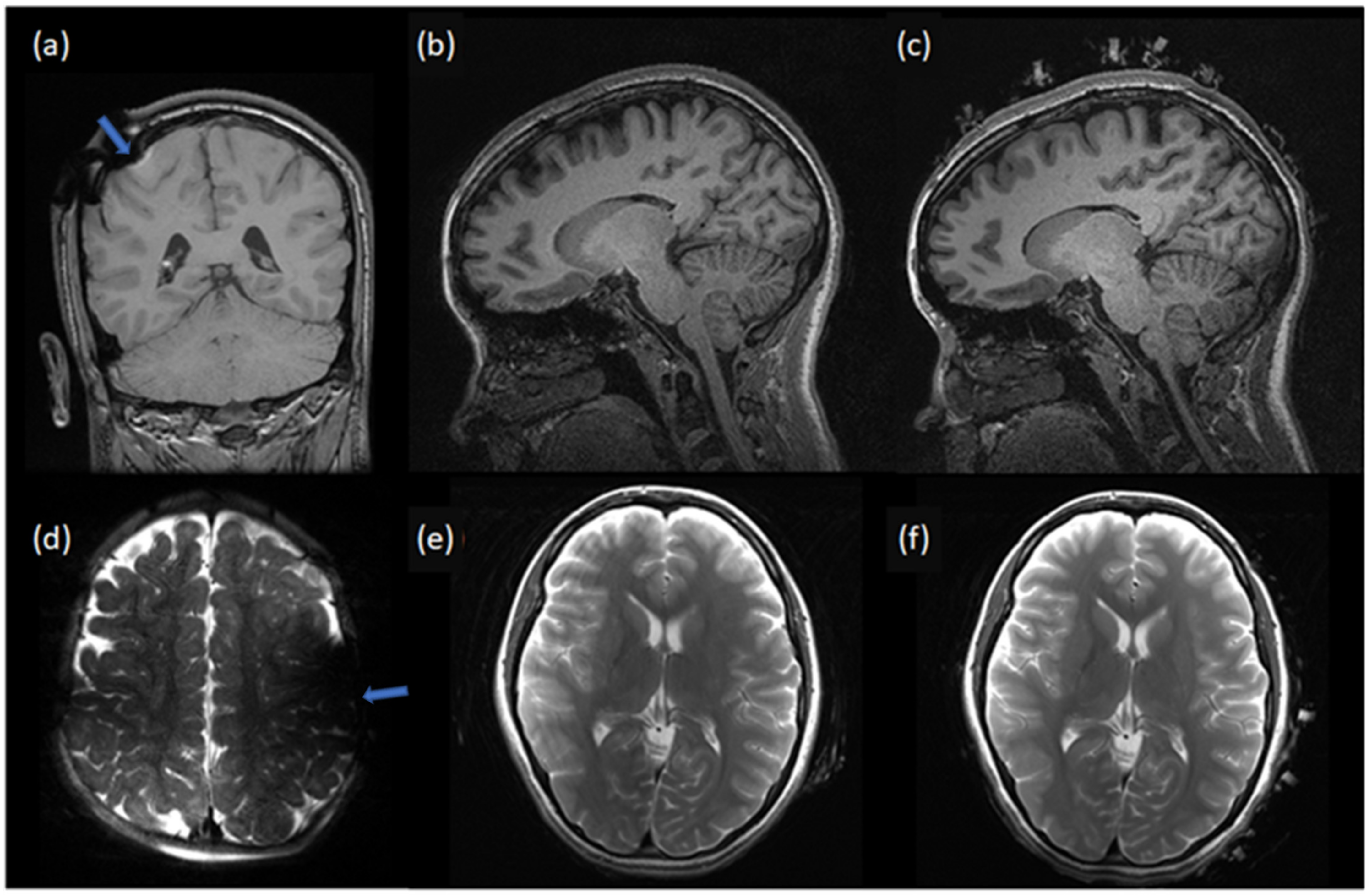 Sensors 23 03633 g006 Sensors 23 03633 g006