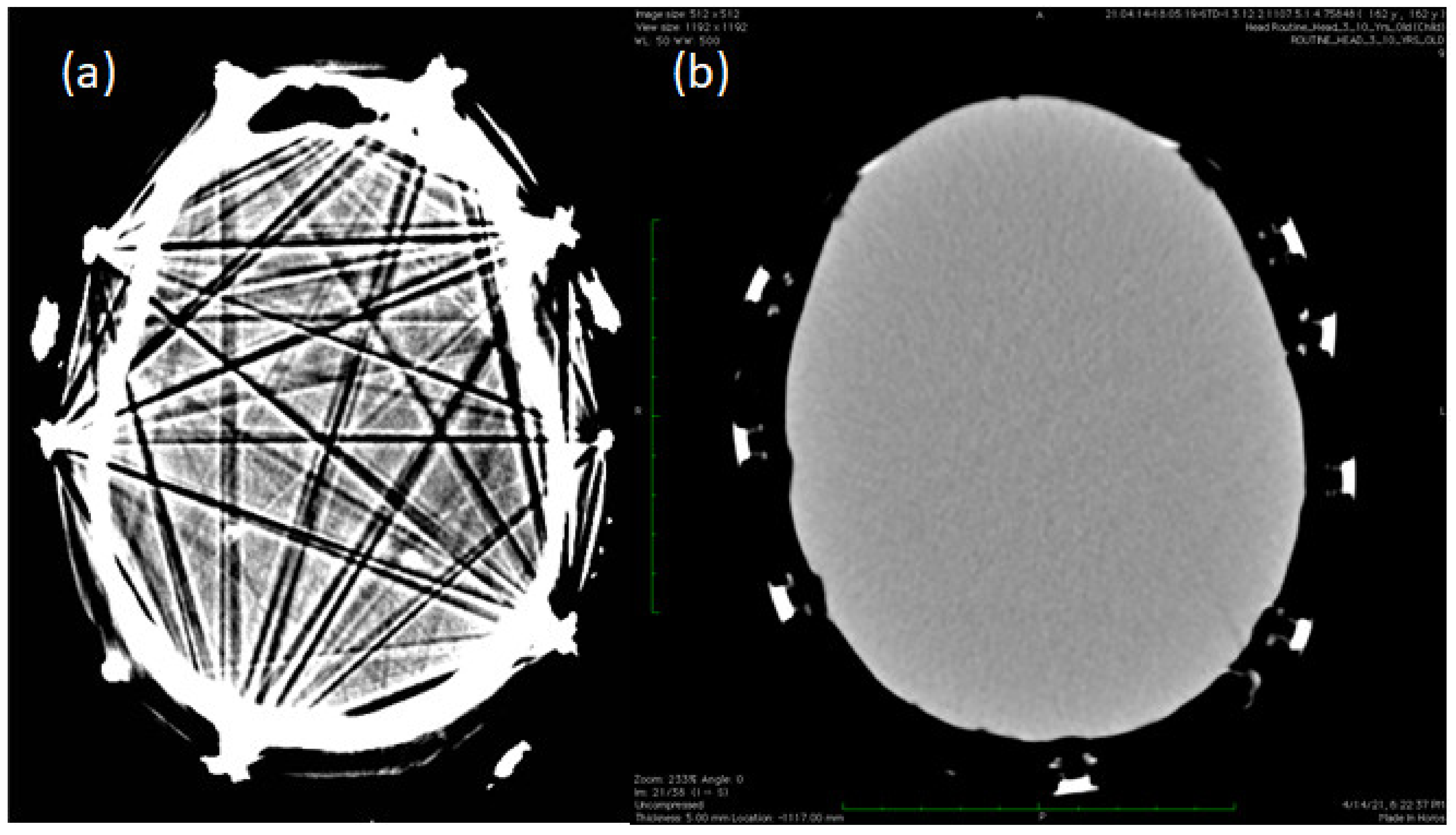 Sensors 23 03633 g008 Sensors 23 03633 g008
