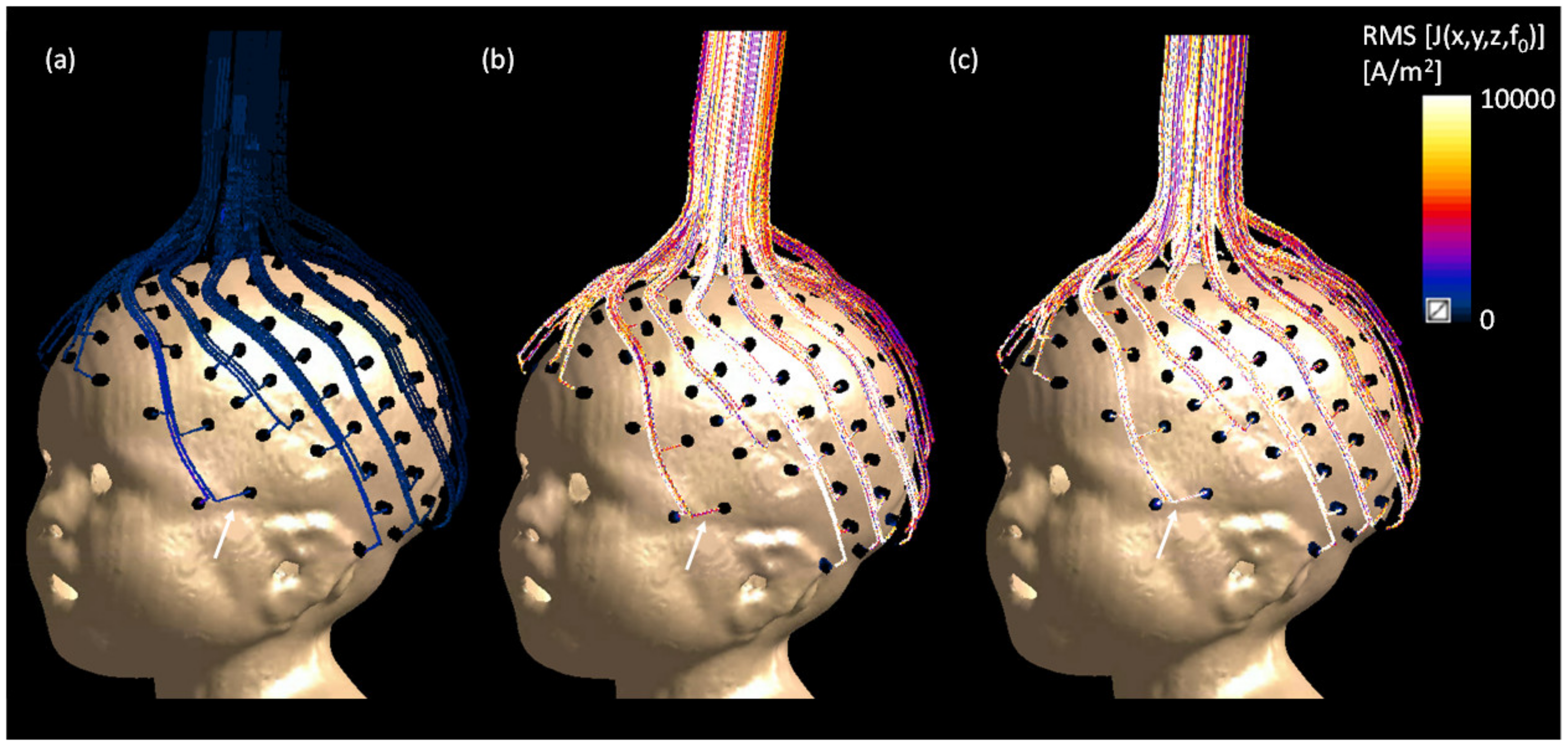 Sensors 23 03633 g011 Sensors 23 03633 g011