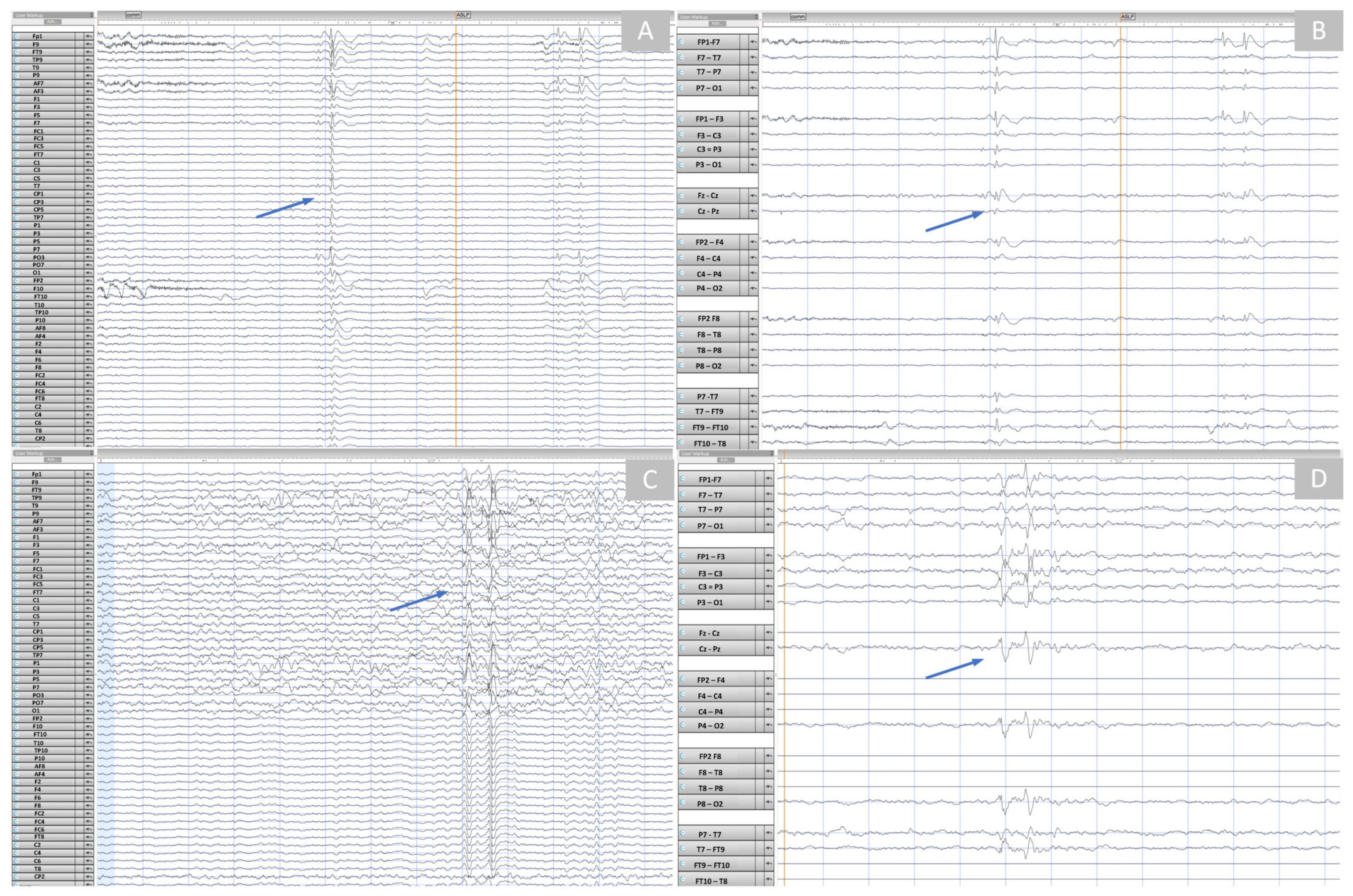 Sensors 23 03633 g012 Sensors 23 03633 g012