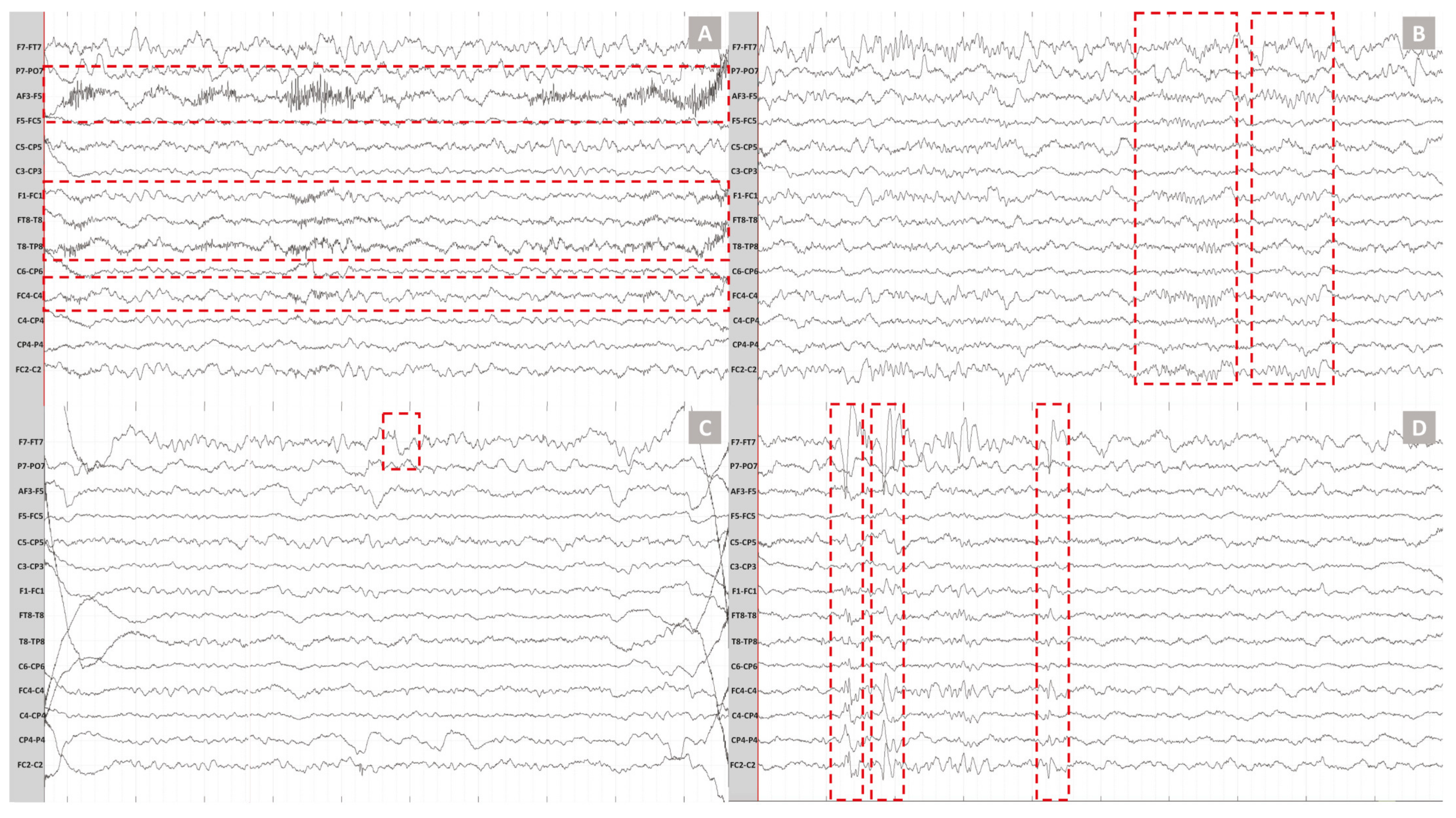 Sensors 23 03633 g013 Sensors 23 03633 g013