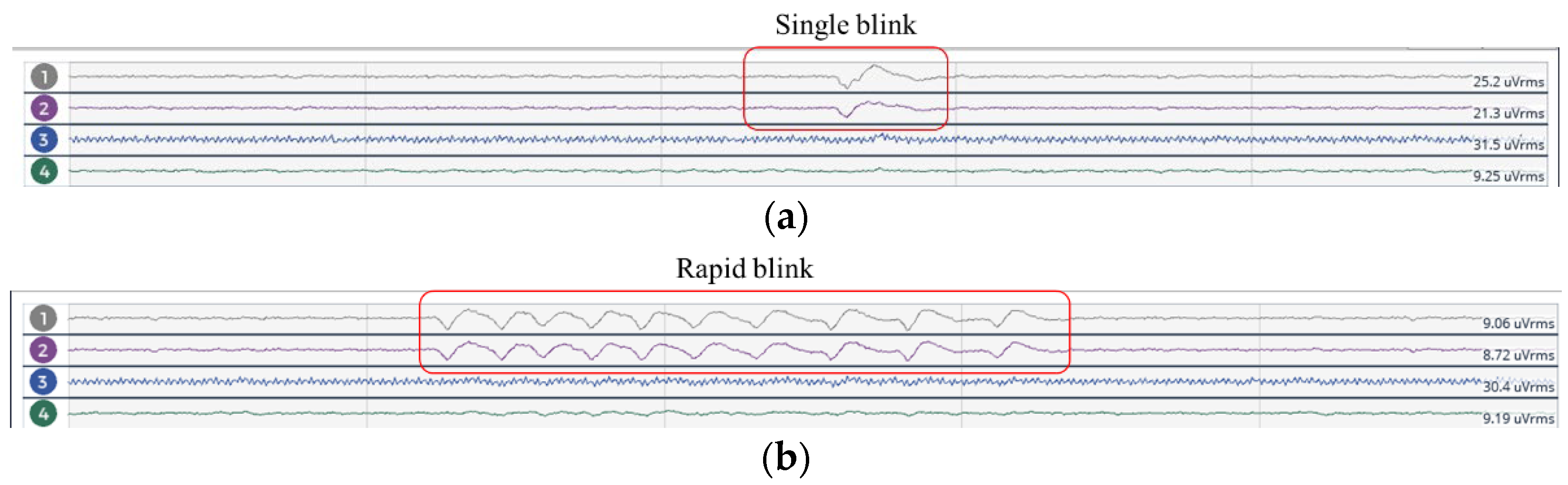 Sensors 23 03654 g009 Sensors 23 03654 g009