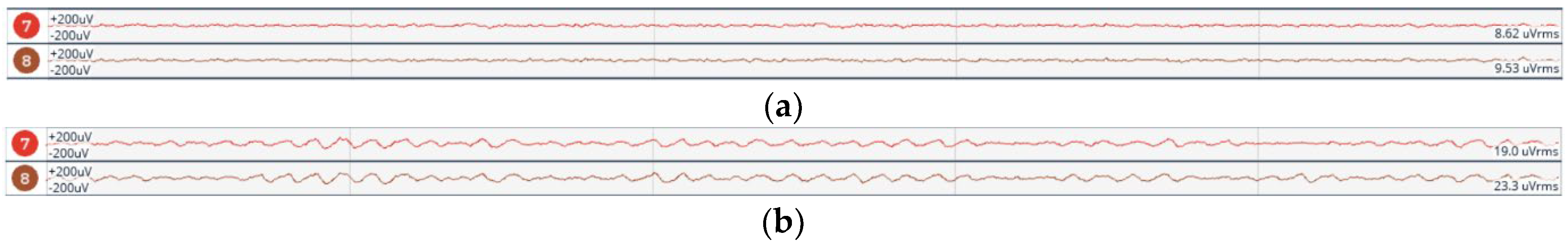 Sensors 23 03654 g011 Sensors 23 03654 g011