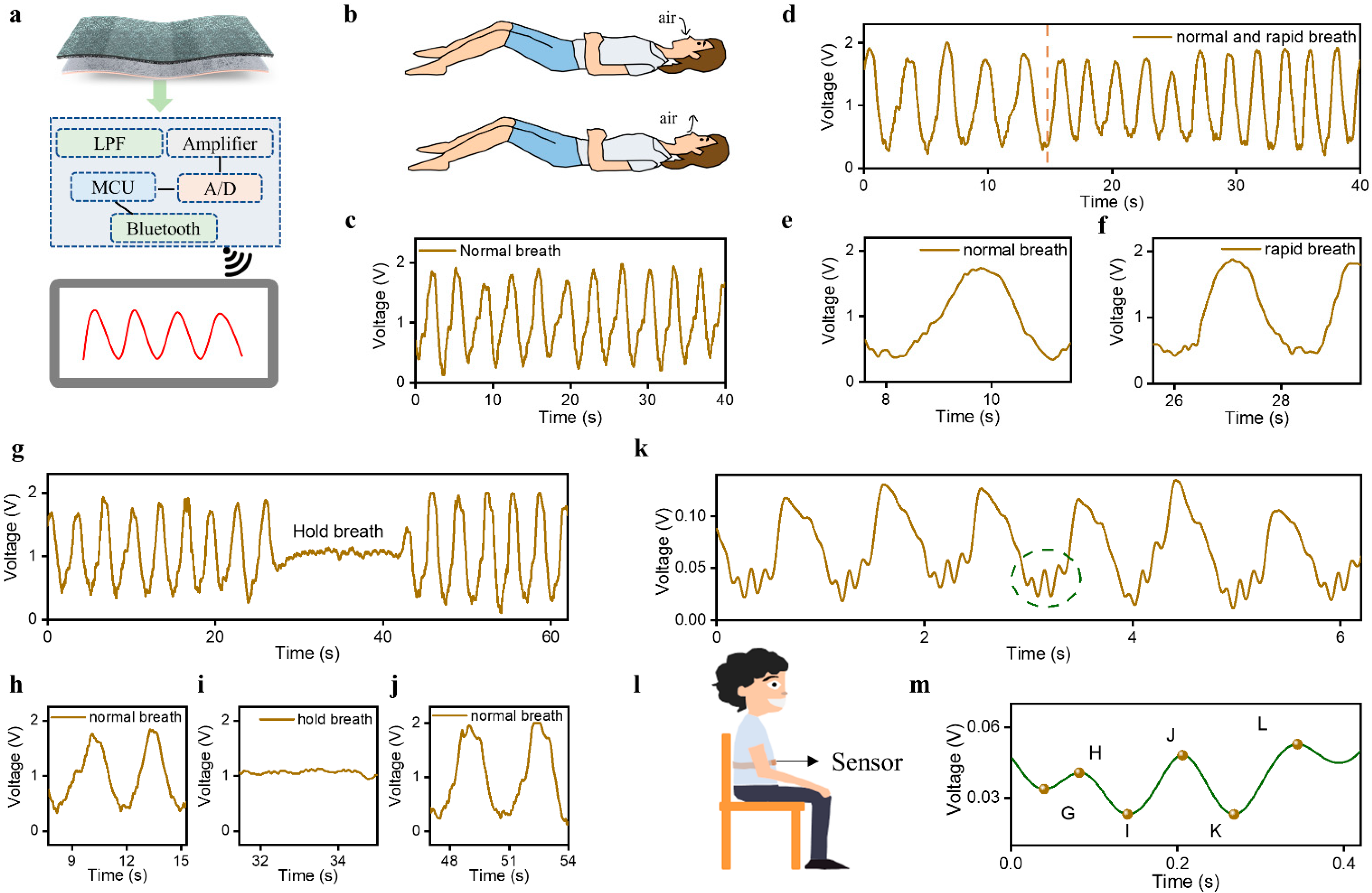 Sensors 23 03717 g003