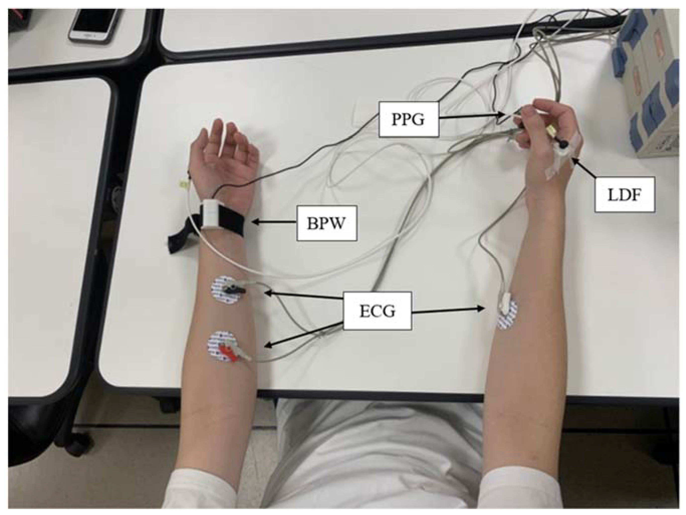 Sensors 23 03855 g001