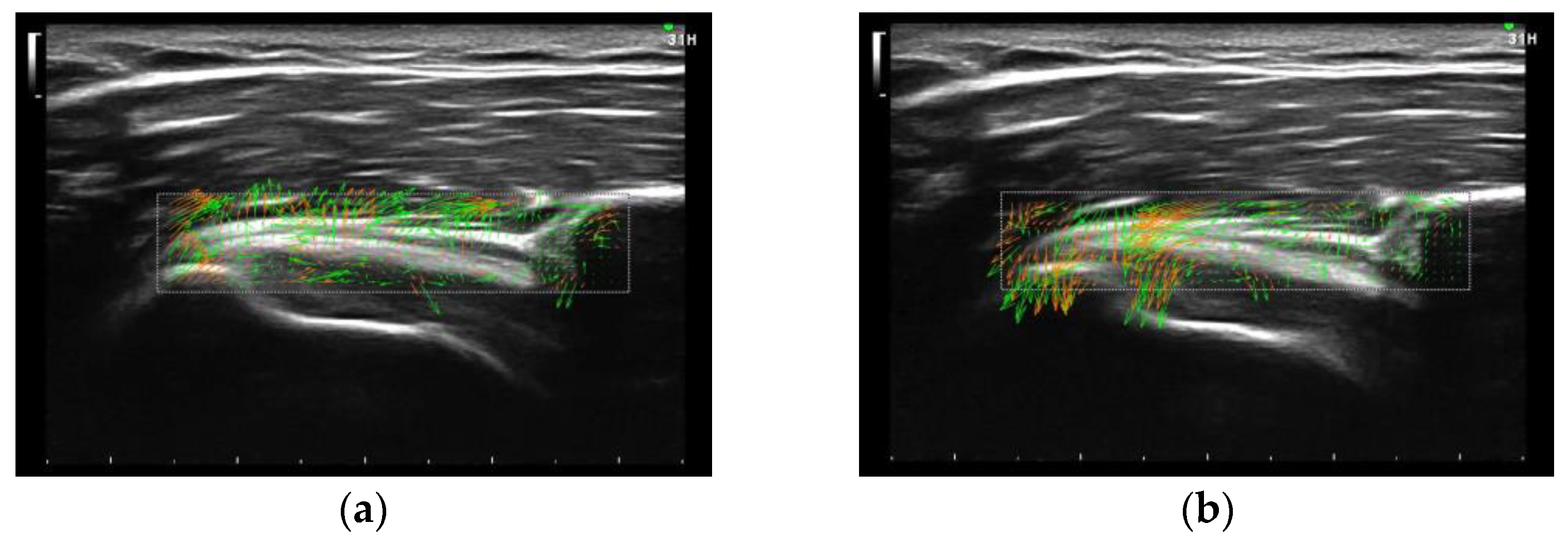 Sensors 23 04015 g006 Sensors 23 04015 g006