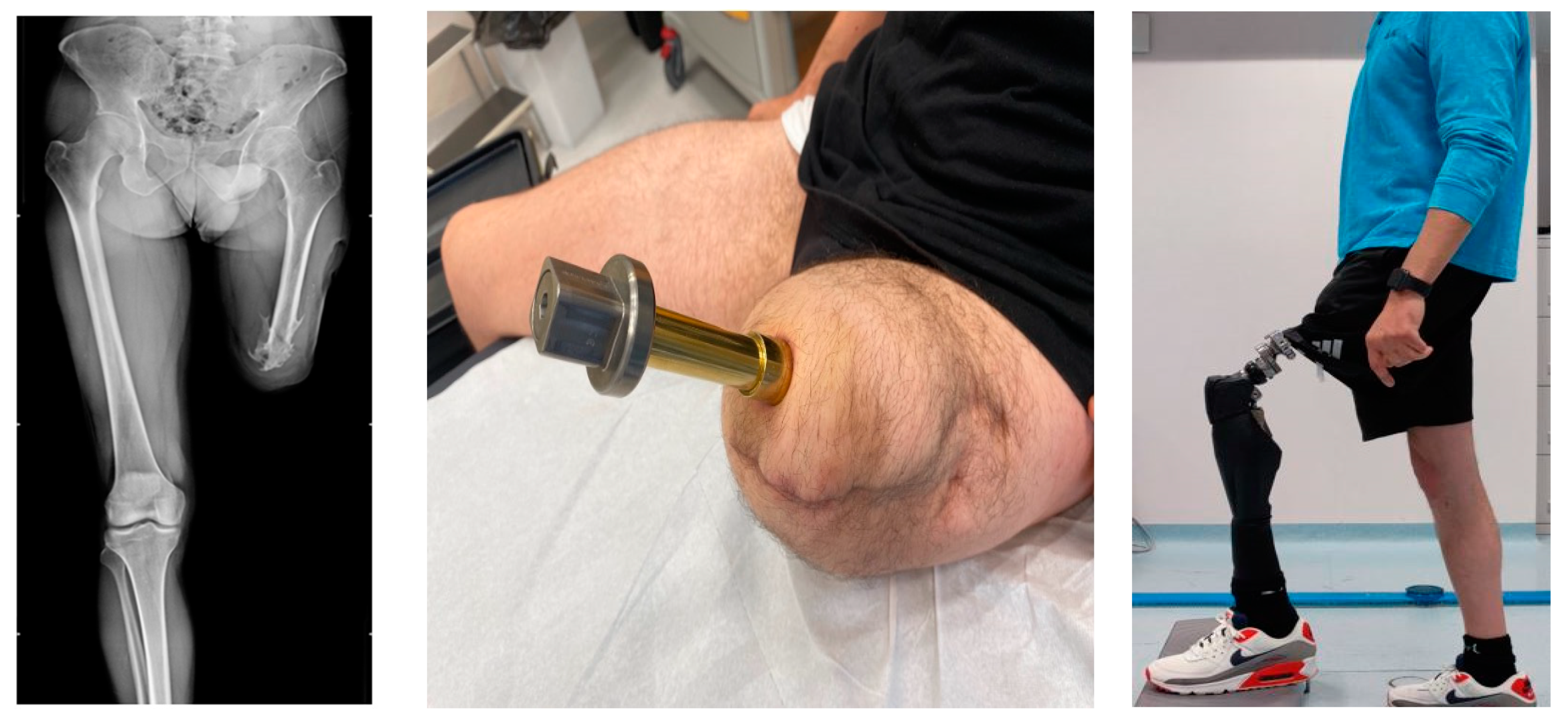 Sensors 23 04037 g002