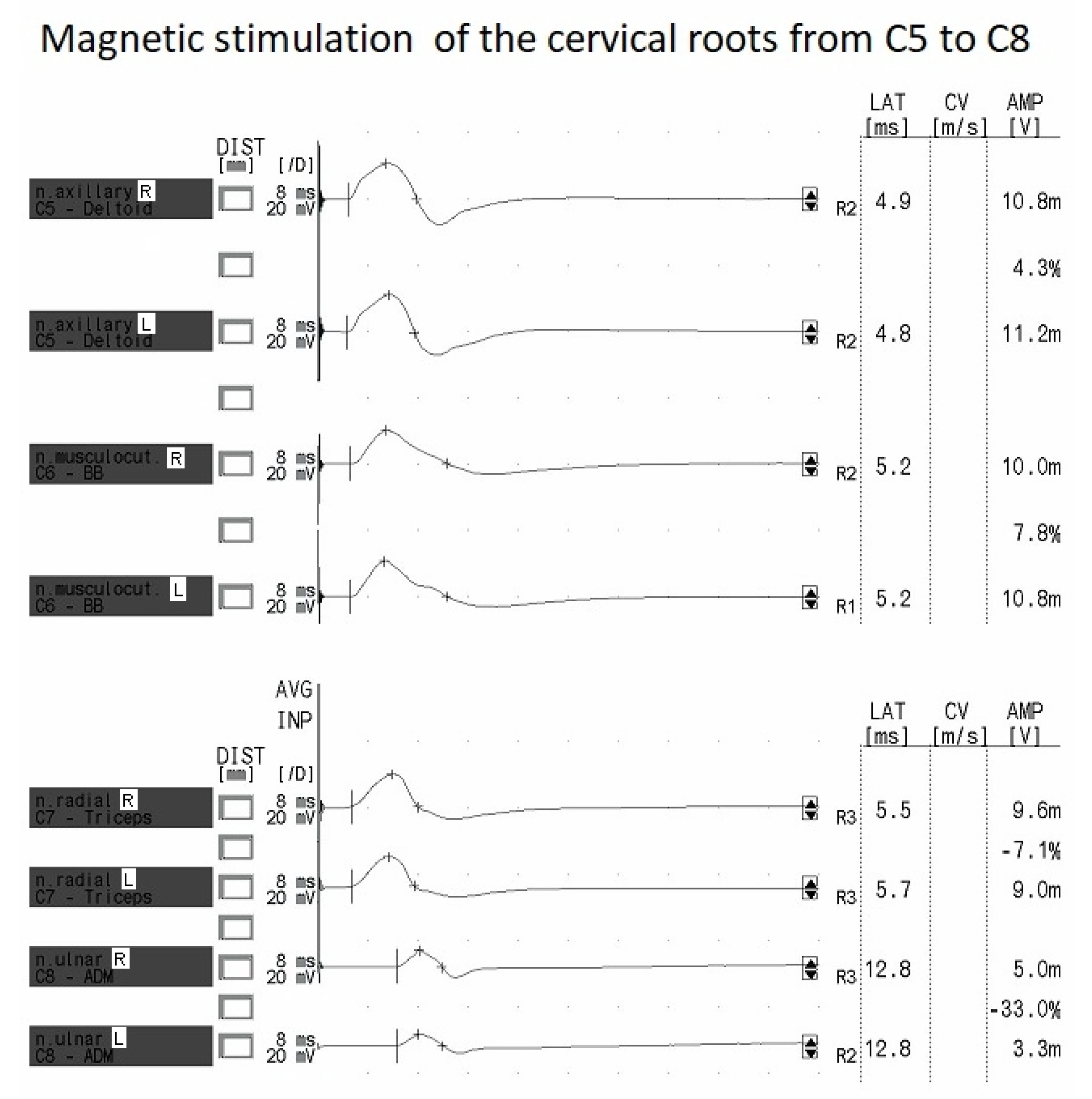 Sensors 23 04175 g005