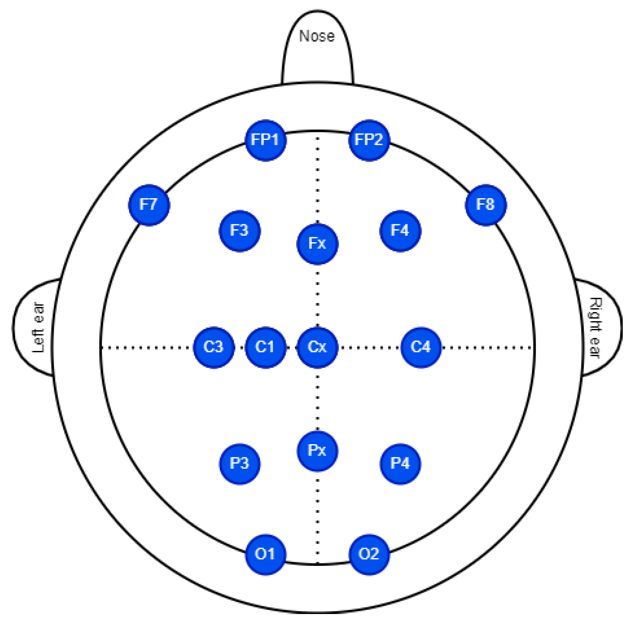 Sensors 23 04277 g005 Sensors 23 04277 g005