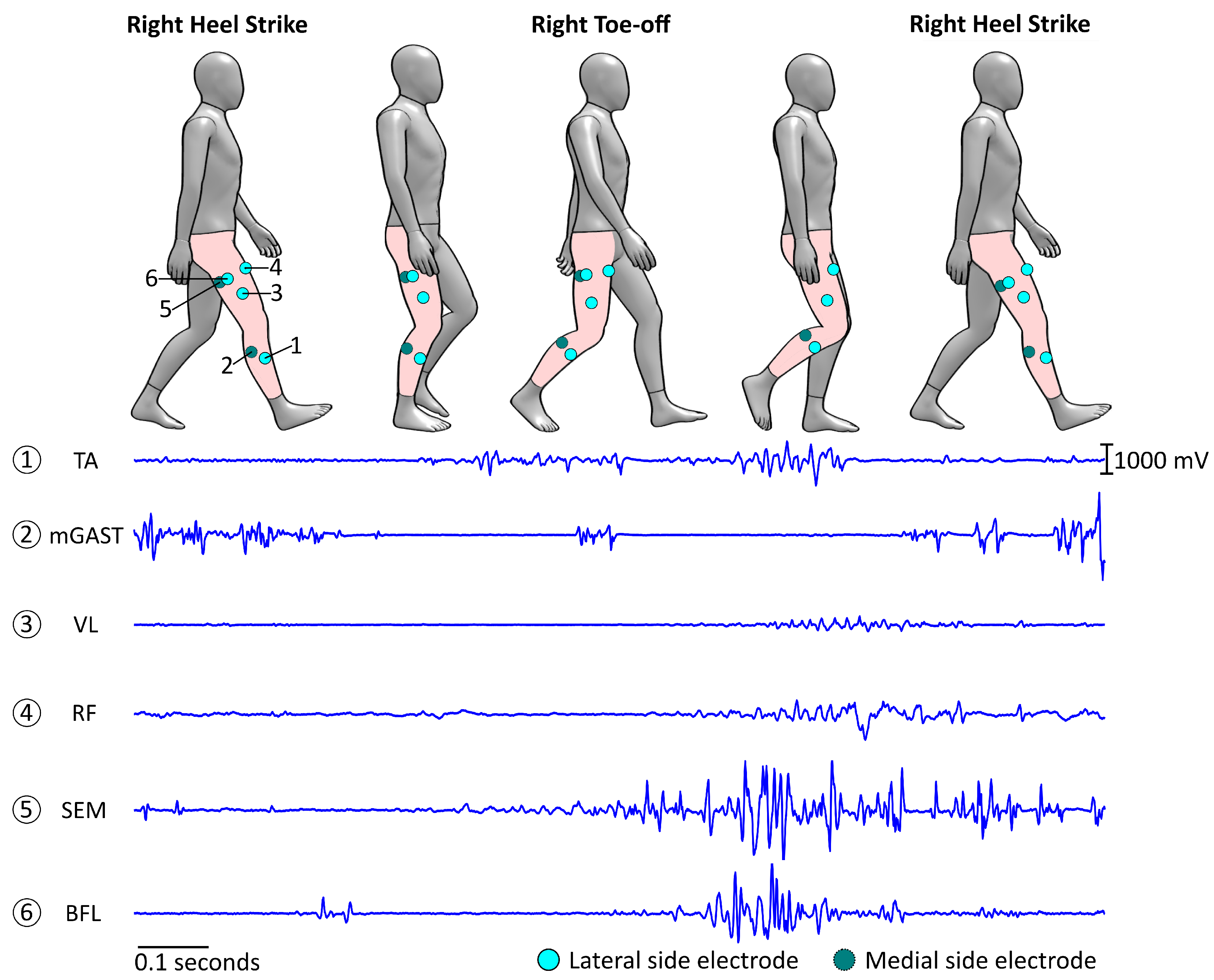 Sensors 23 04340 g005