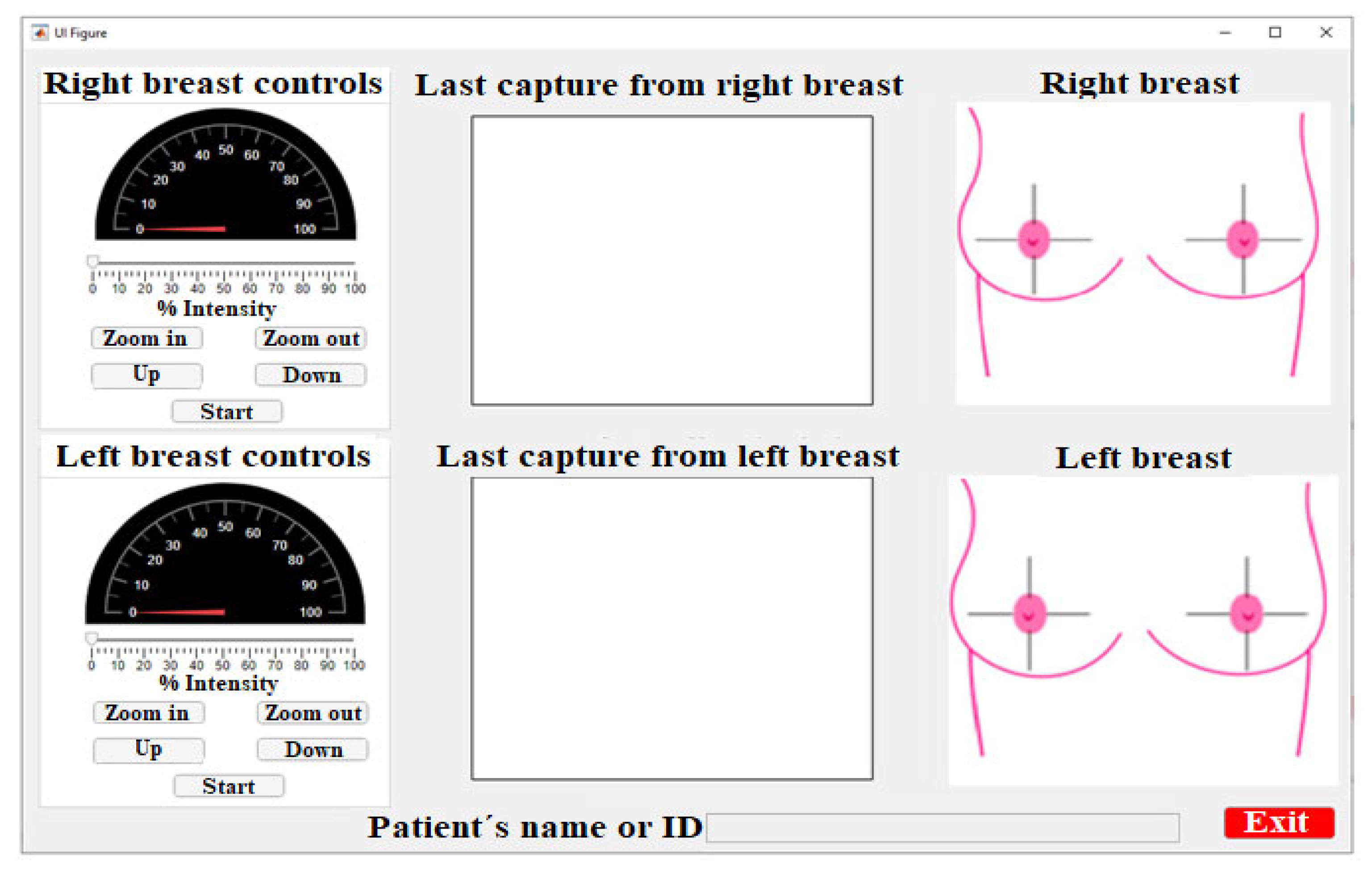 Sensors 23 04390 g005