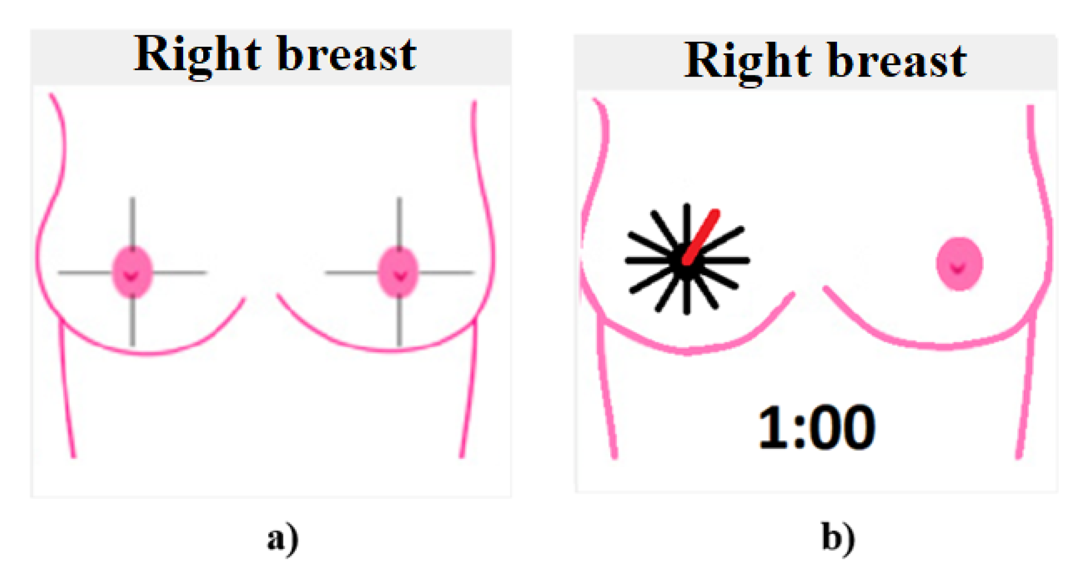 Sensors 23 04390 g006