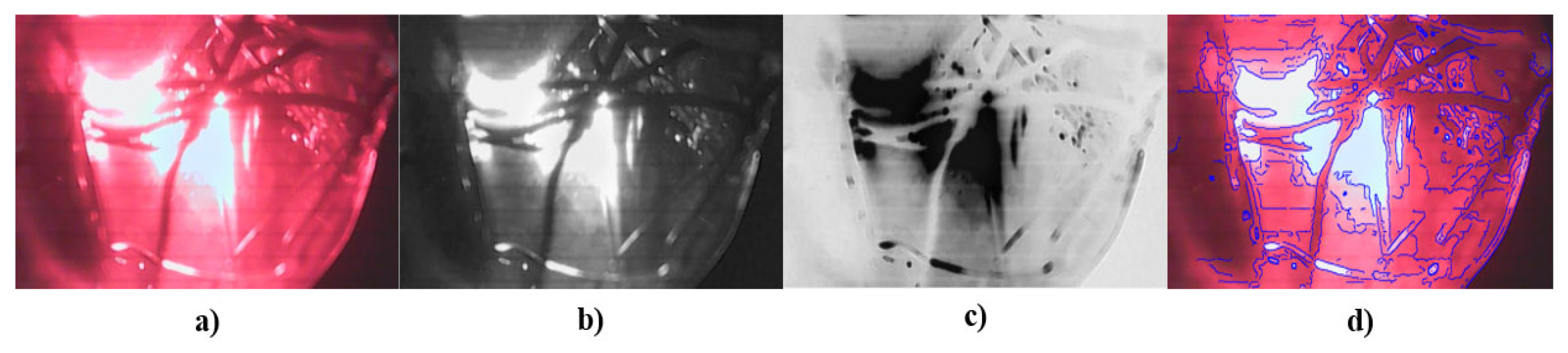 Sensors 23 04390 g014