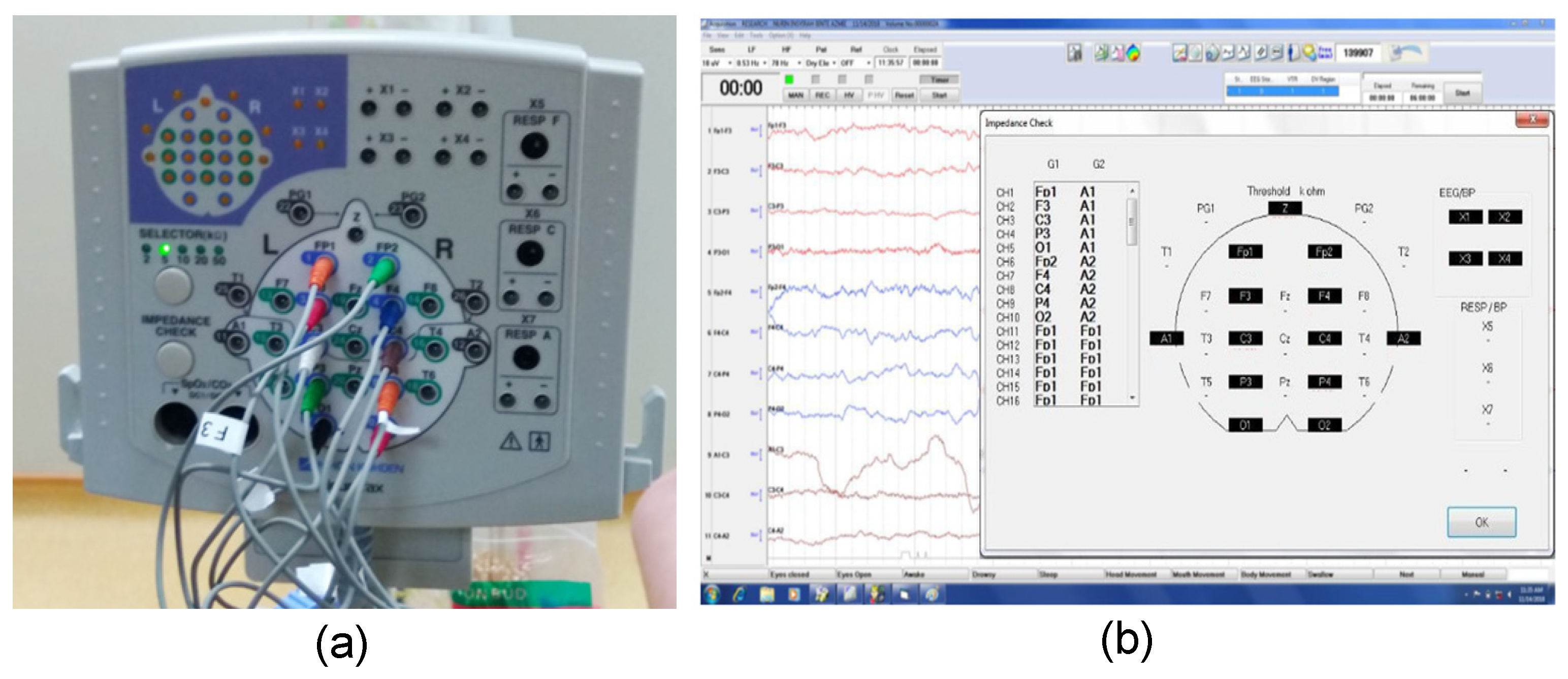 Sensors | Free Full-Text | Development of Low-Contact-Impedance Dry ...