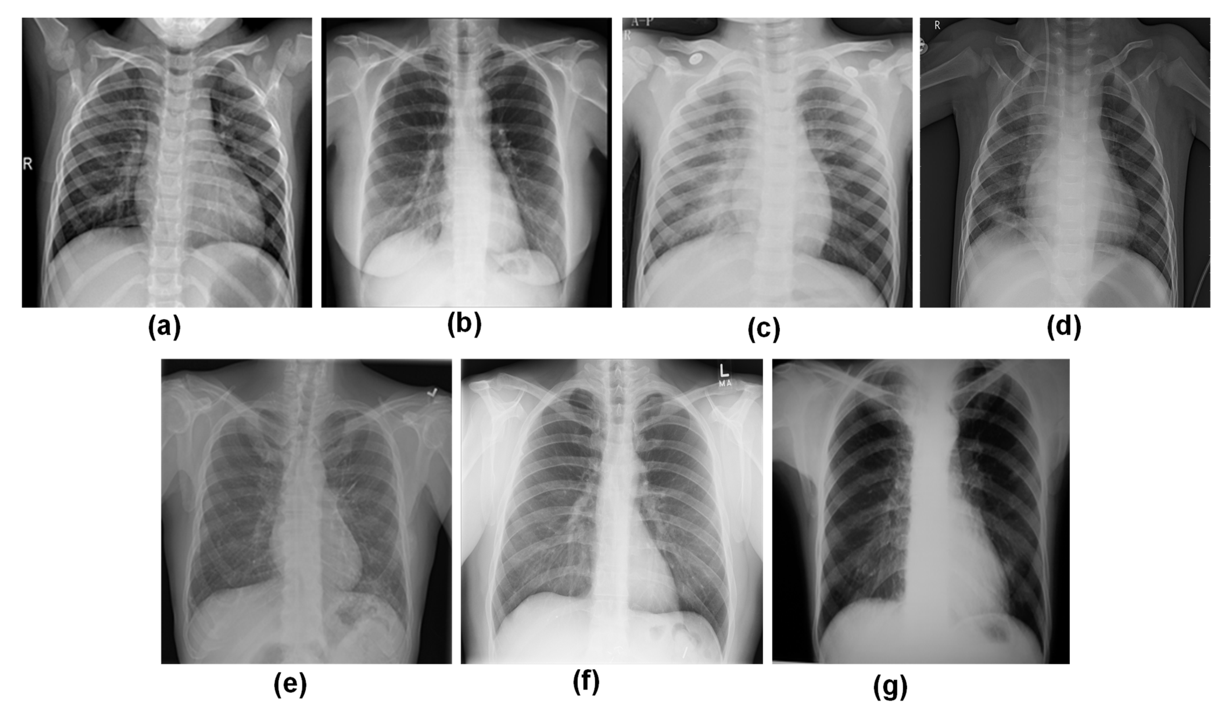 Sensors 23 04458 g002