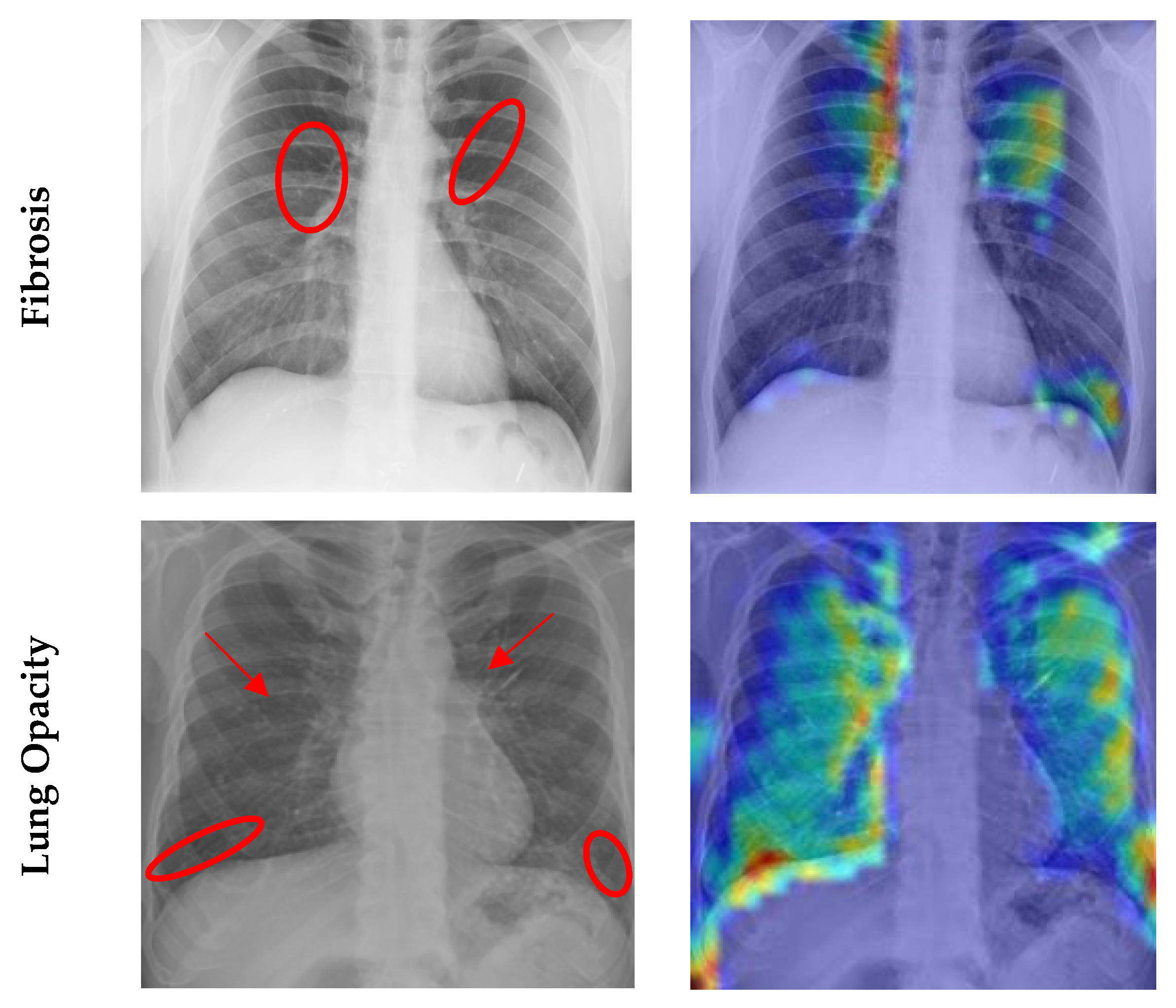 Sensors 23 04458 g017b