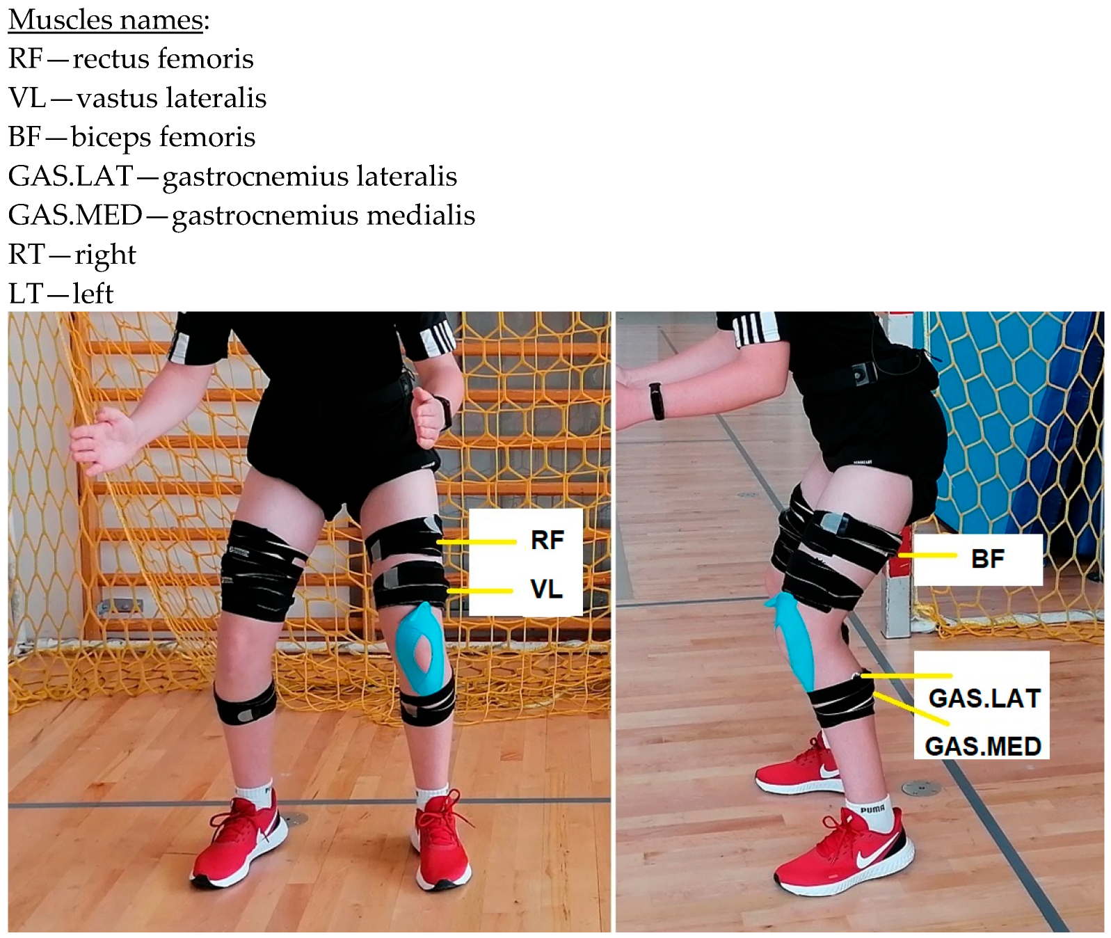 Sensors 23 04483 g001 Sensors 23 04483 g001