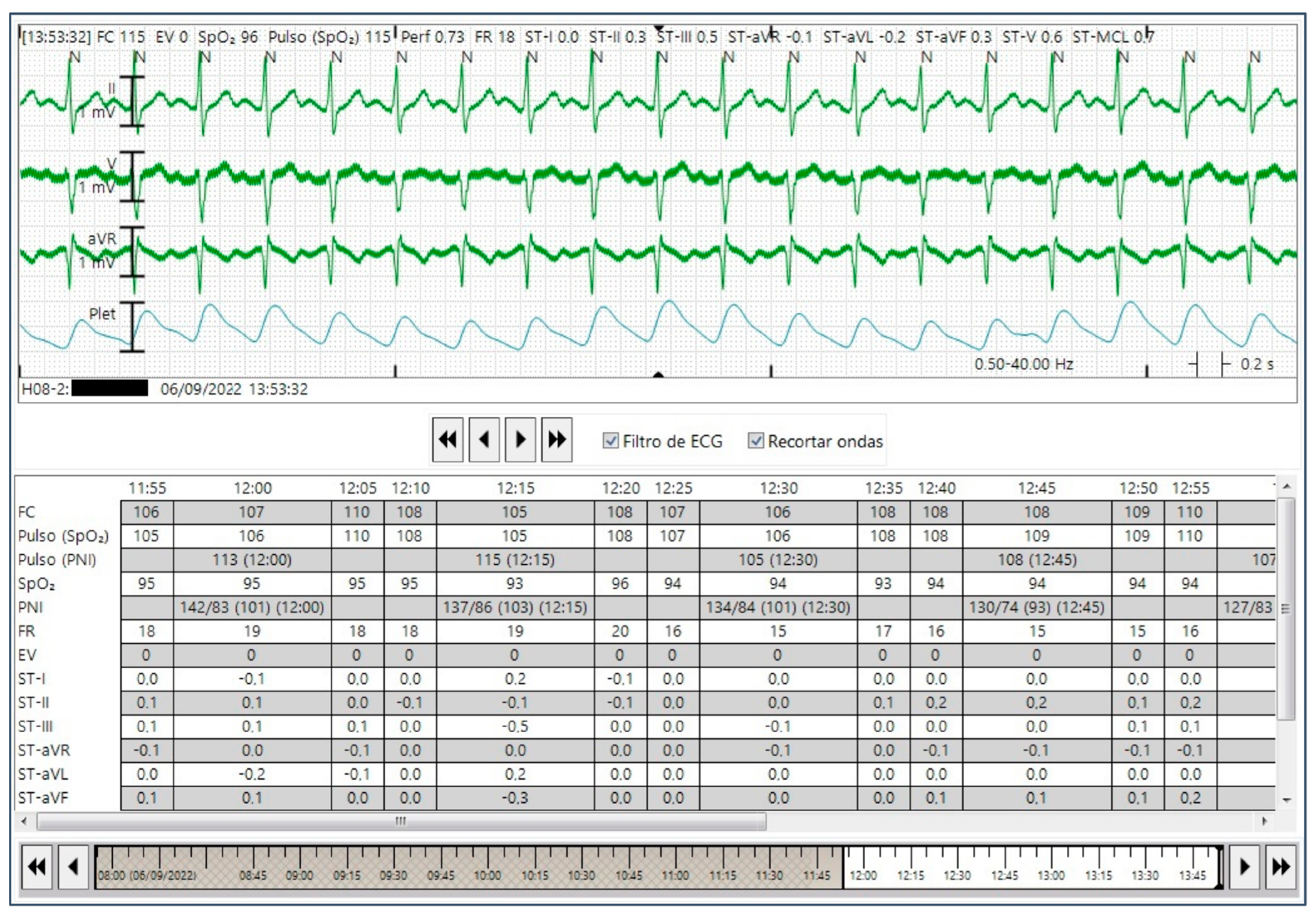 The differences between ECG heart rate monitors and optical heart