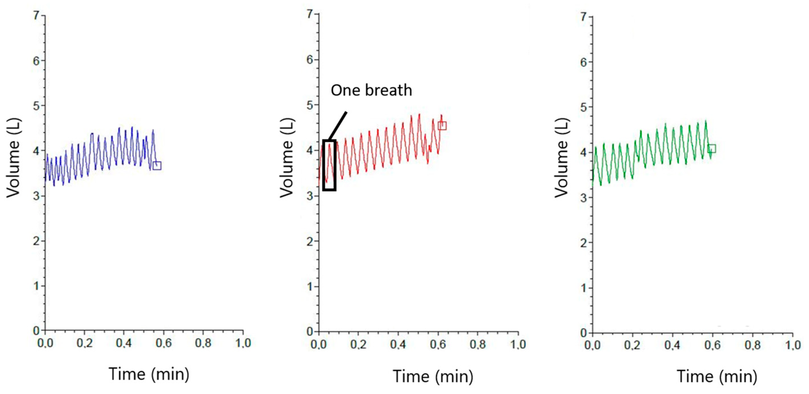 Sensors Free FullText Evaluation of a Respiration Rate Sensor for