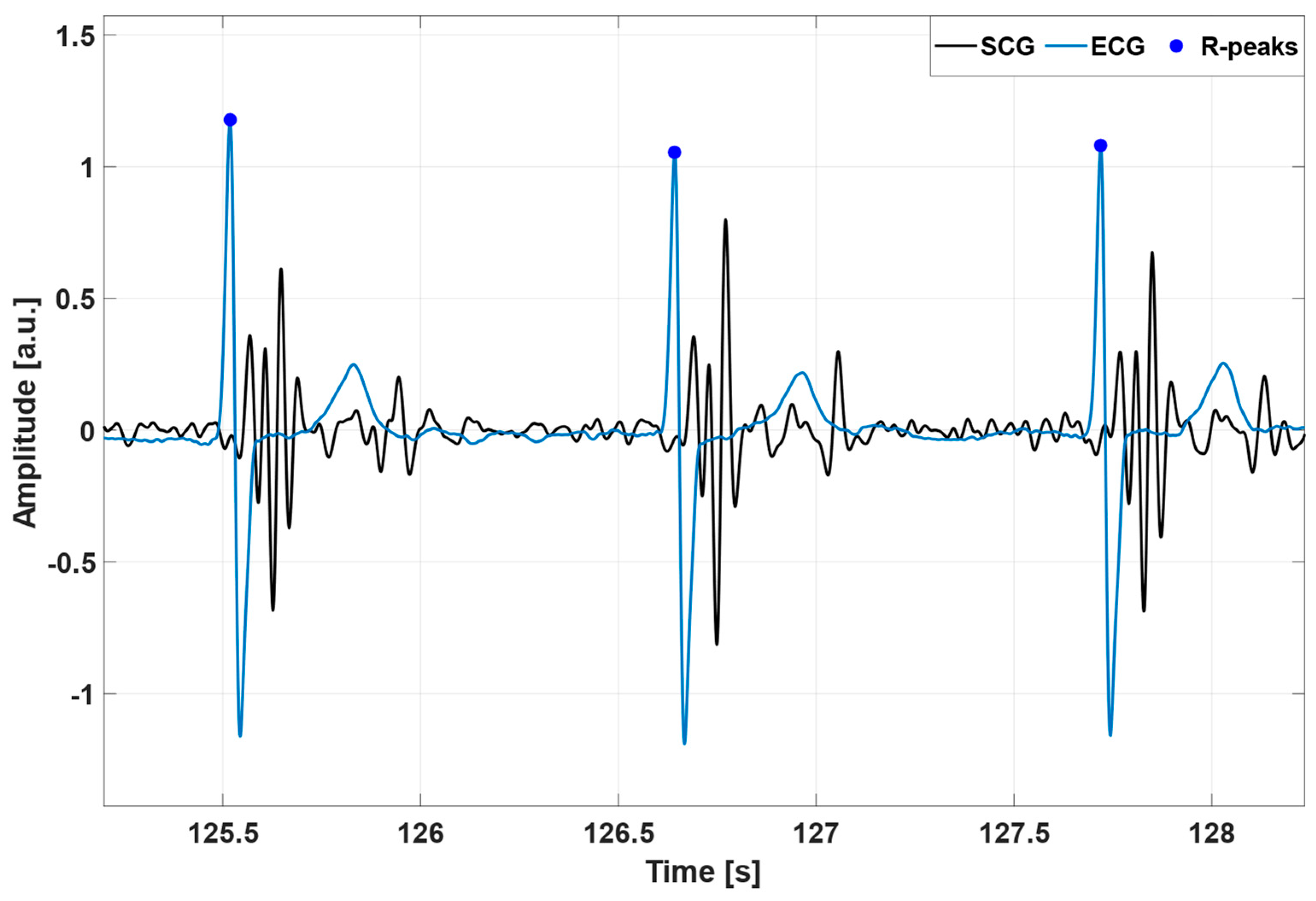 ECG-Free Heartbeat Detection in Seismocardiography Signals via Template ...