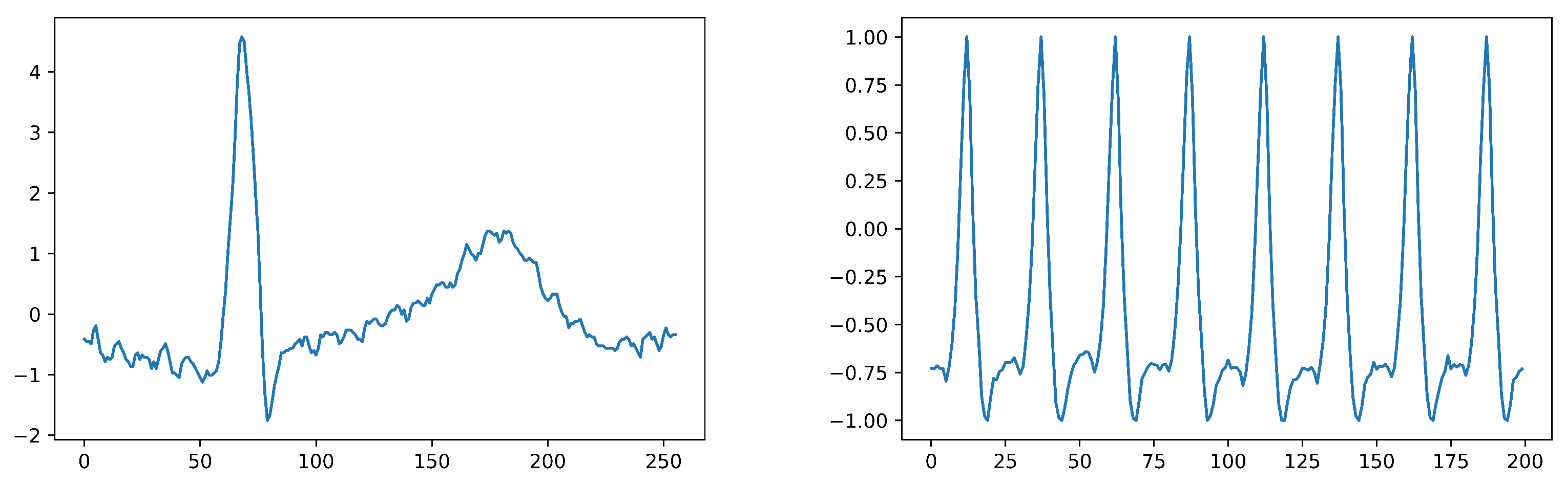 Sensors | Free Full-Text | Ensemble Siamese Network (ESN) Using ECG ...