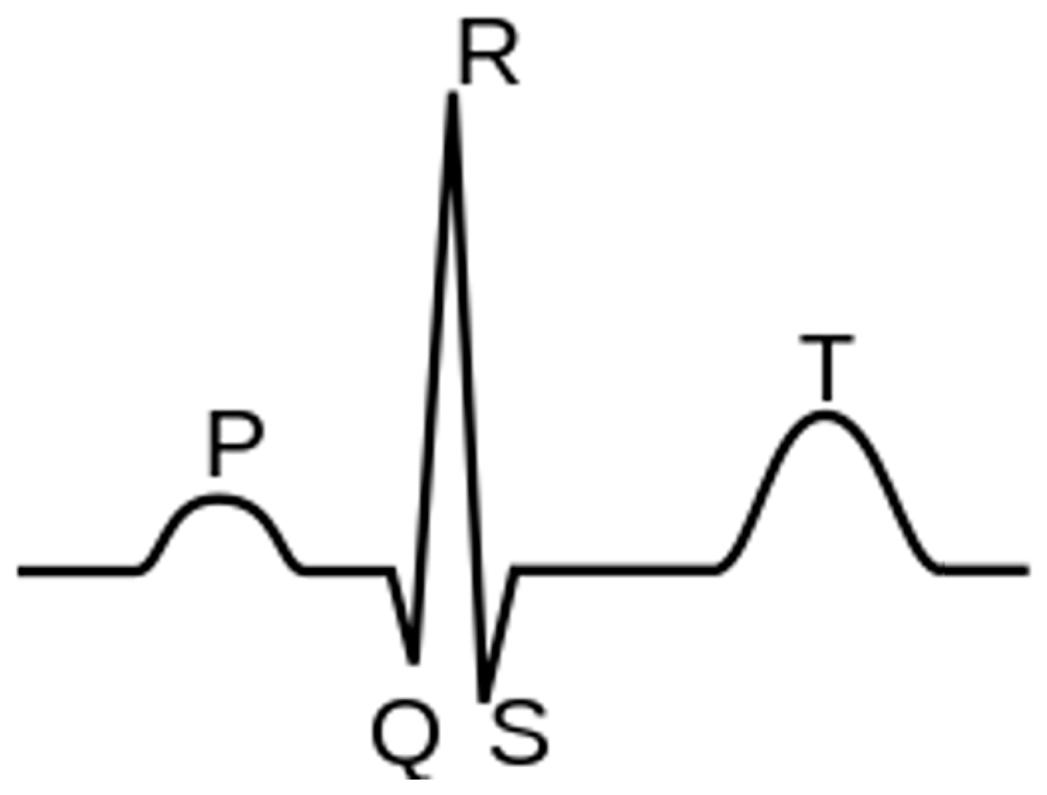 Sensors 23 04805 g003 550