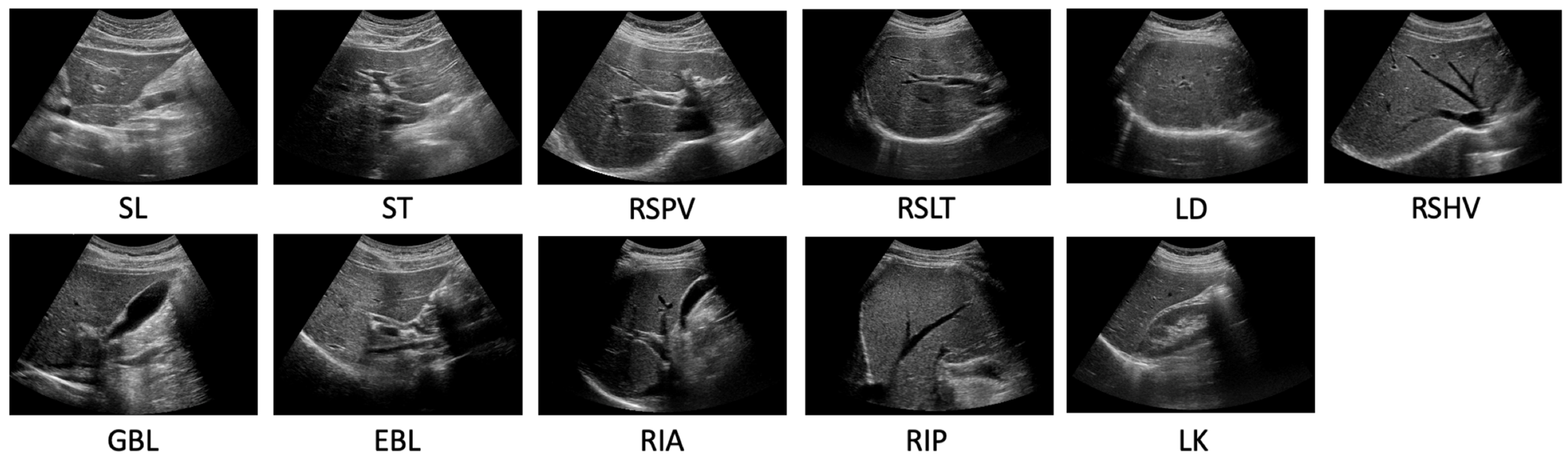 Real-Time Deep Recognition of Standardized Liver Ultrasound Scan Locations