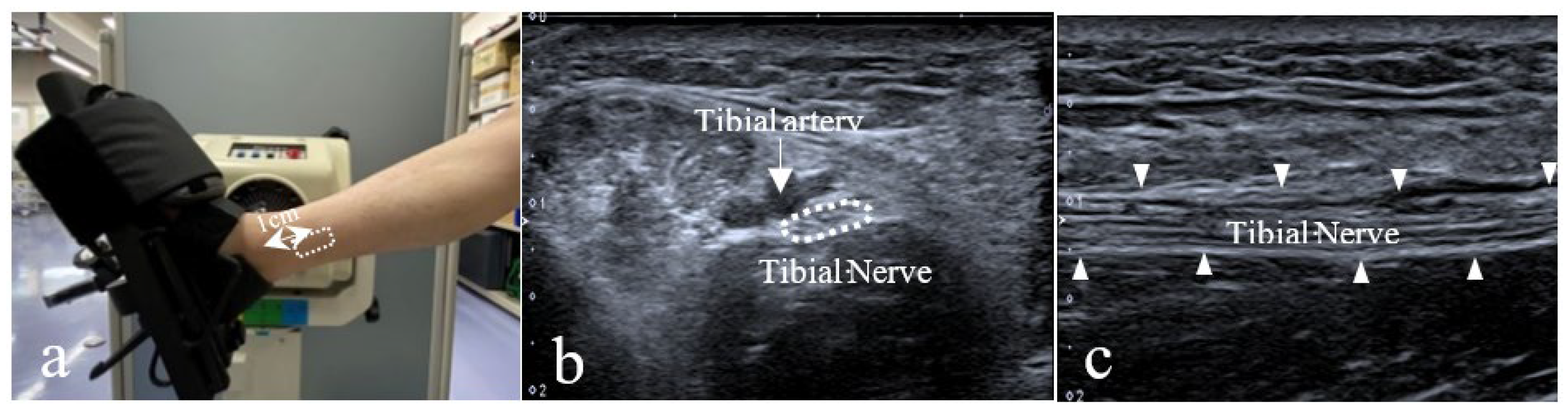 Sensors 23 04855 g001 Sensors 23 04855 g001